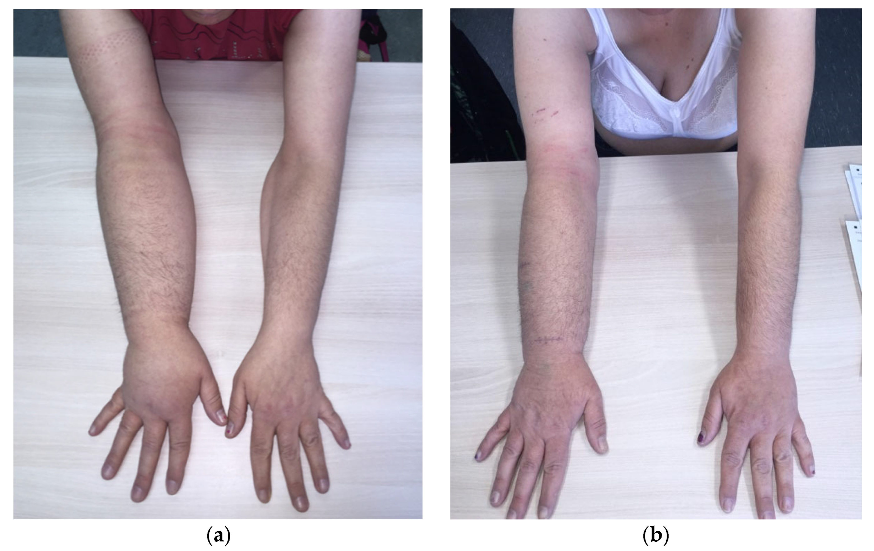 Lymphatics 01 00013 g005