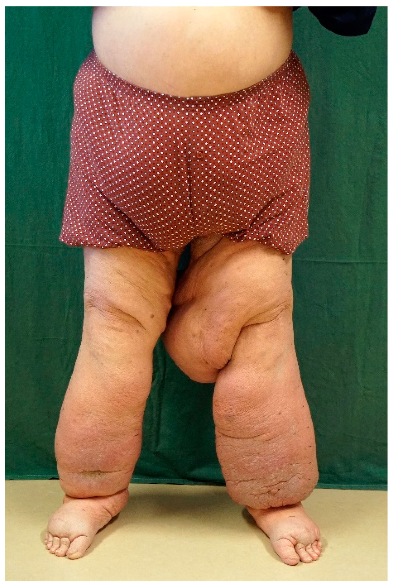 Lymphatics 02 00009 g002