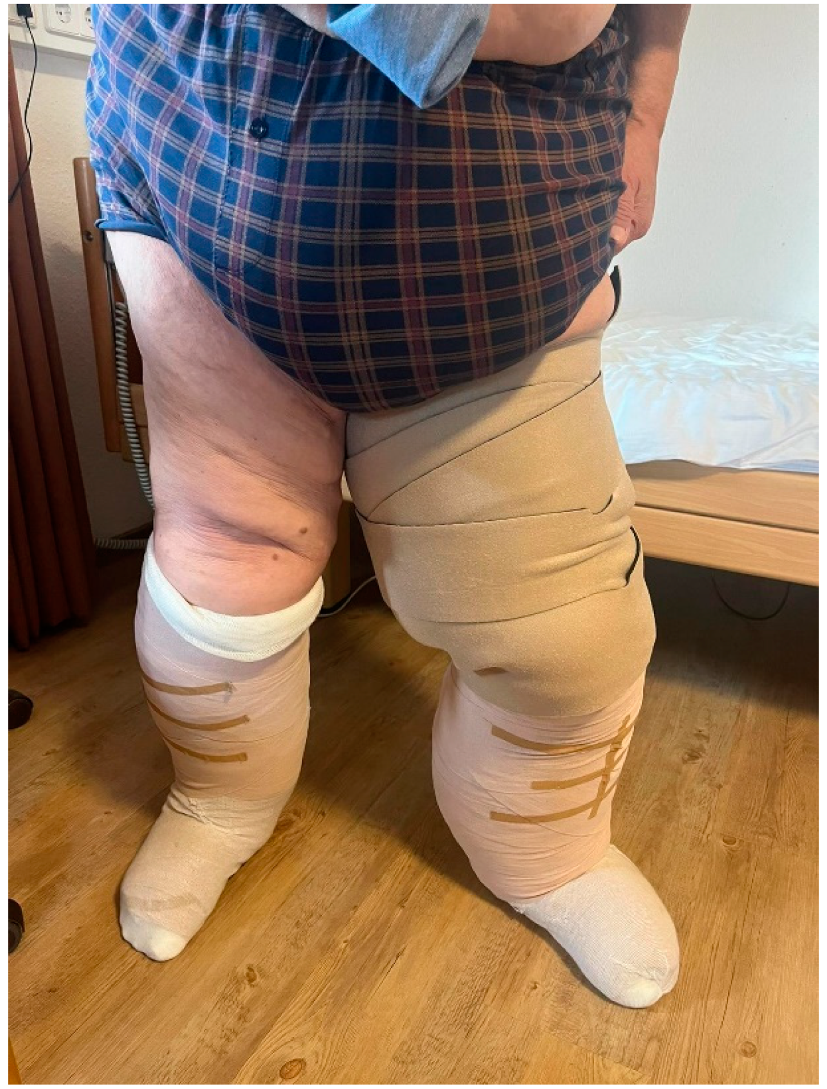 Lymphatics 02 00009 g004