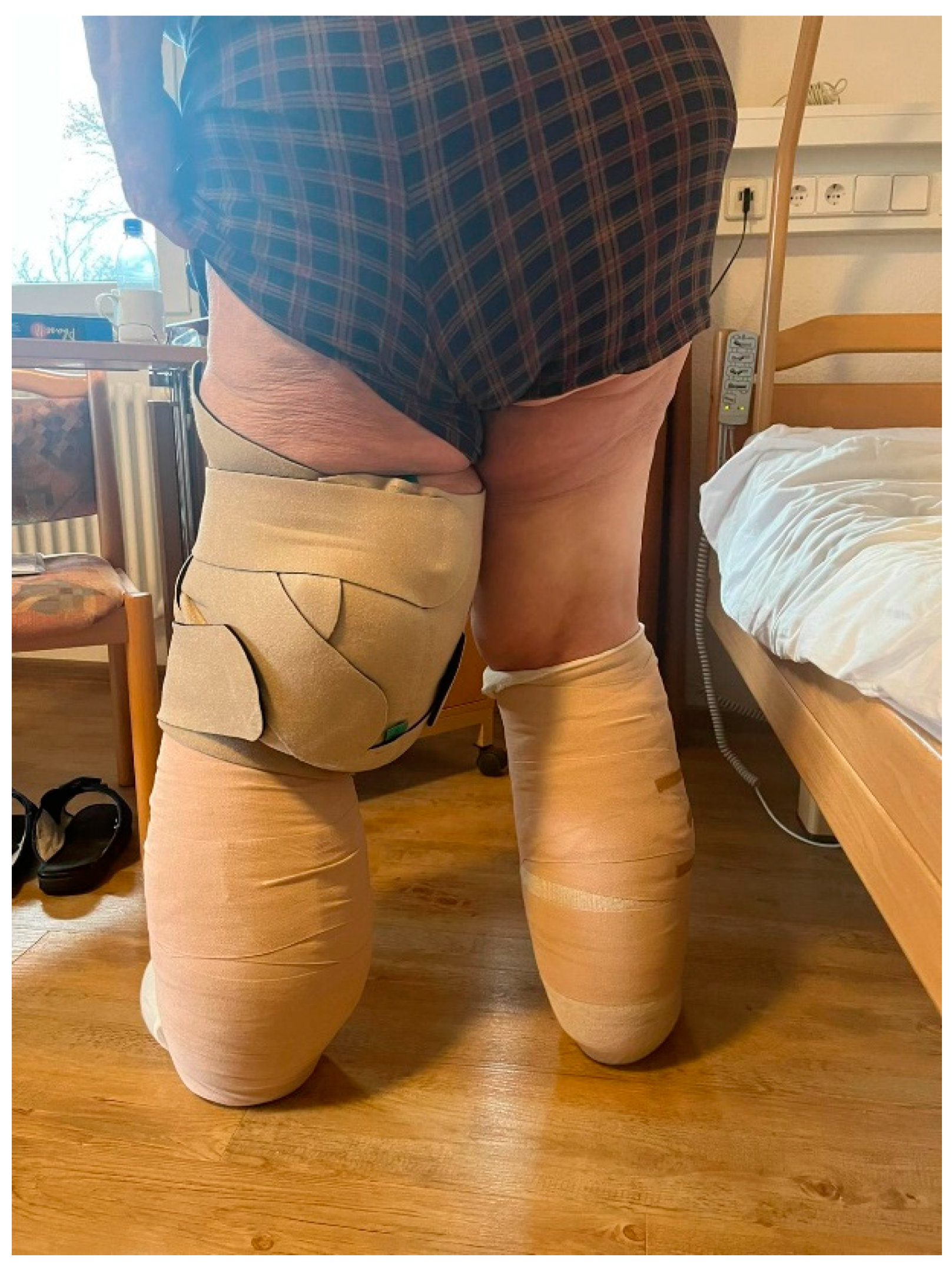 Lymphatics 02 00009 g005