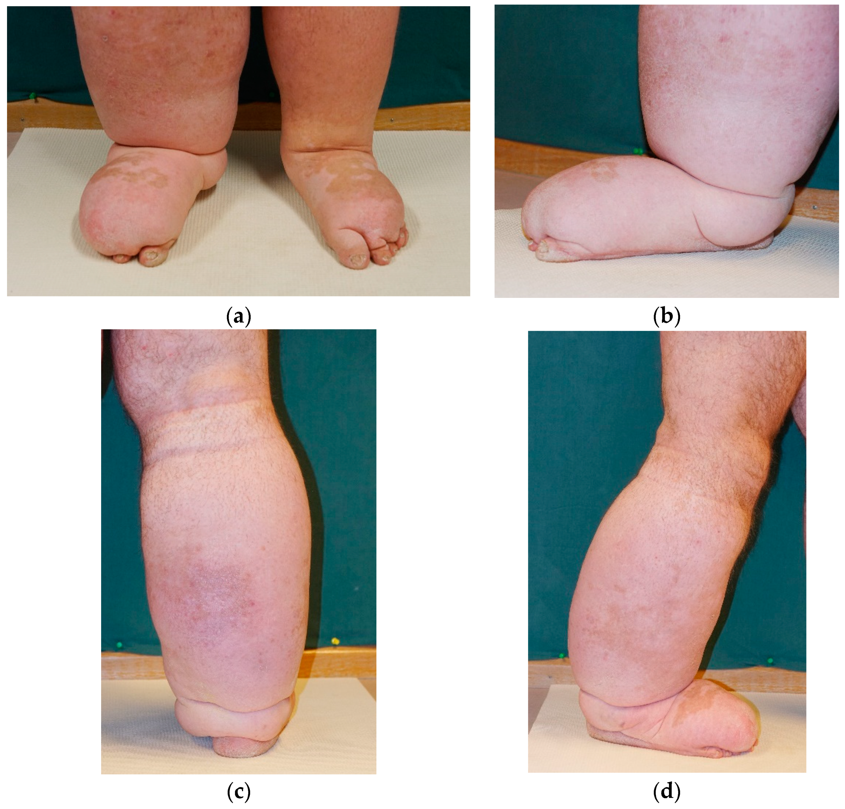 Lymphatics 02 00009 g006