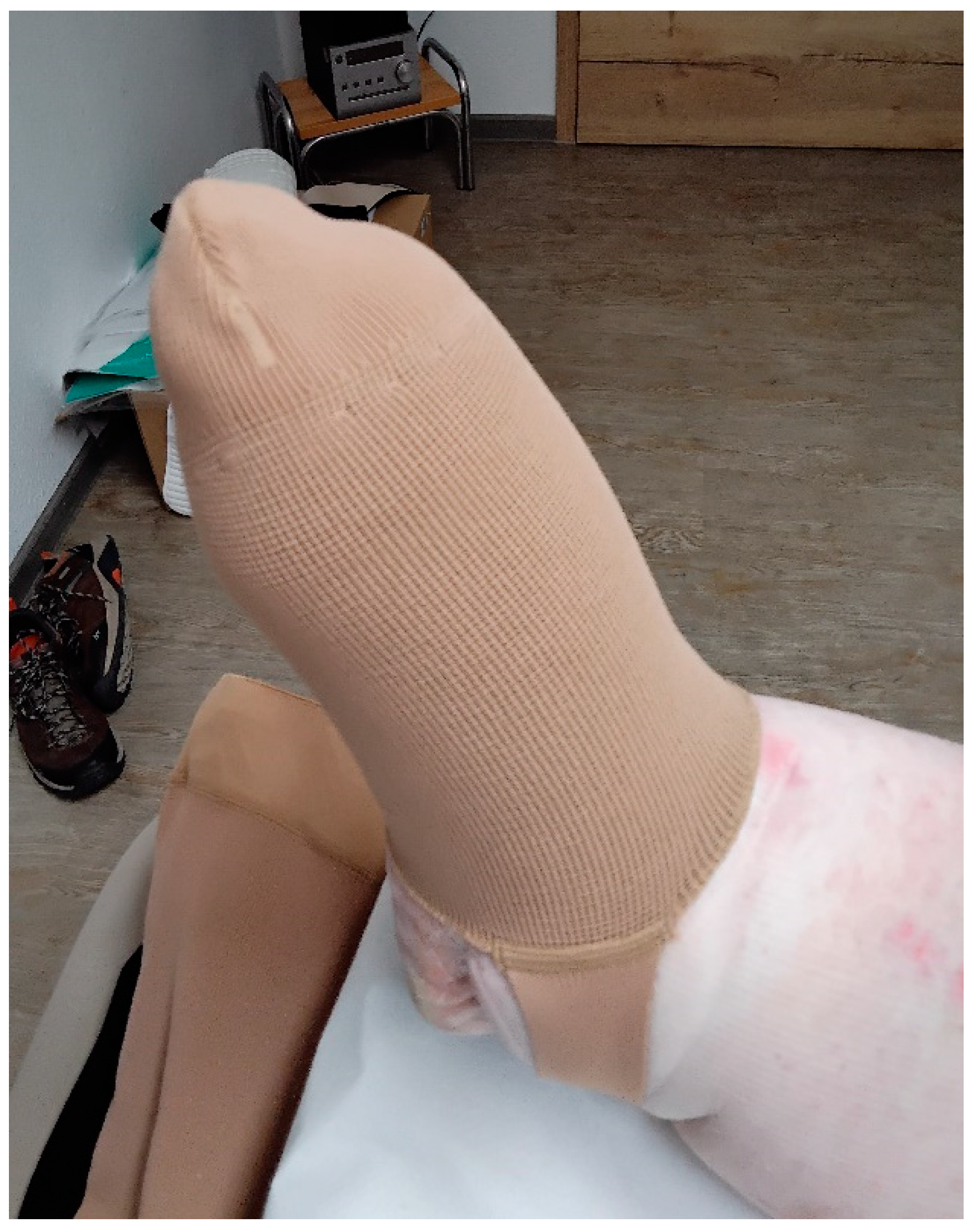 Lymphatics 02 00009 g008