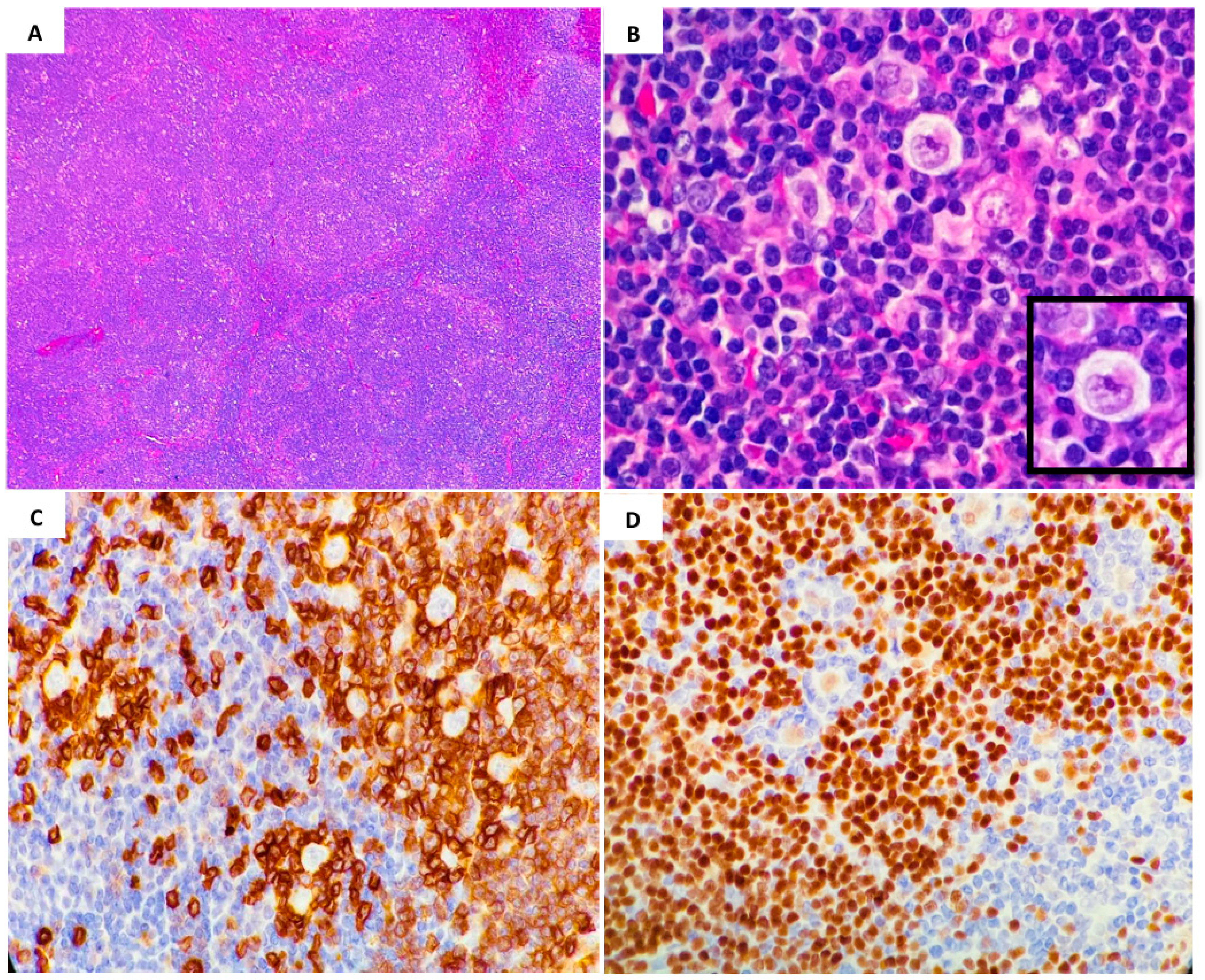 Lymphatics 02 00014 g001