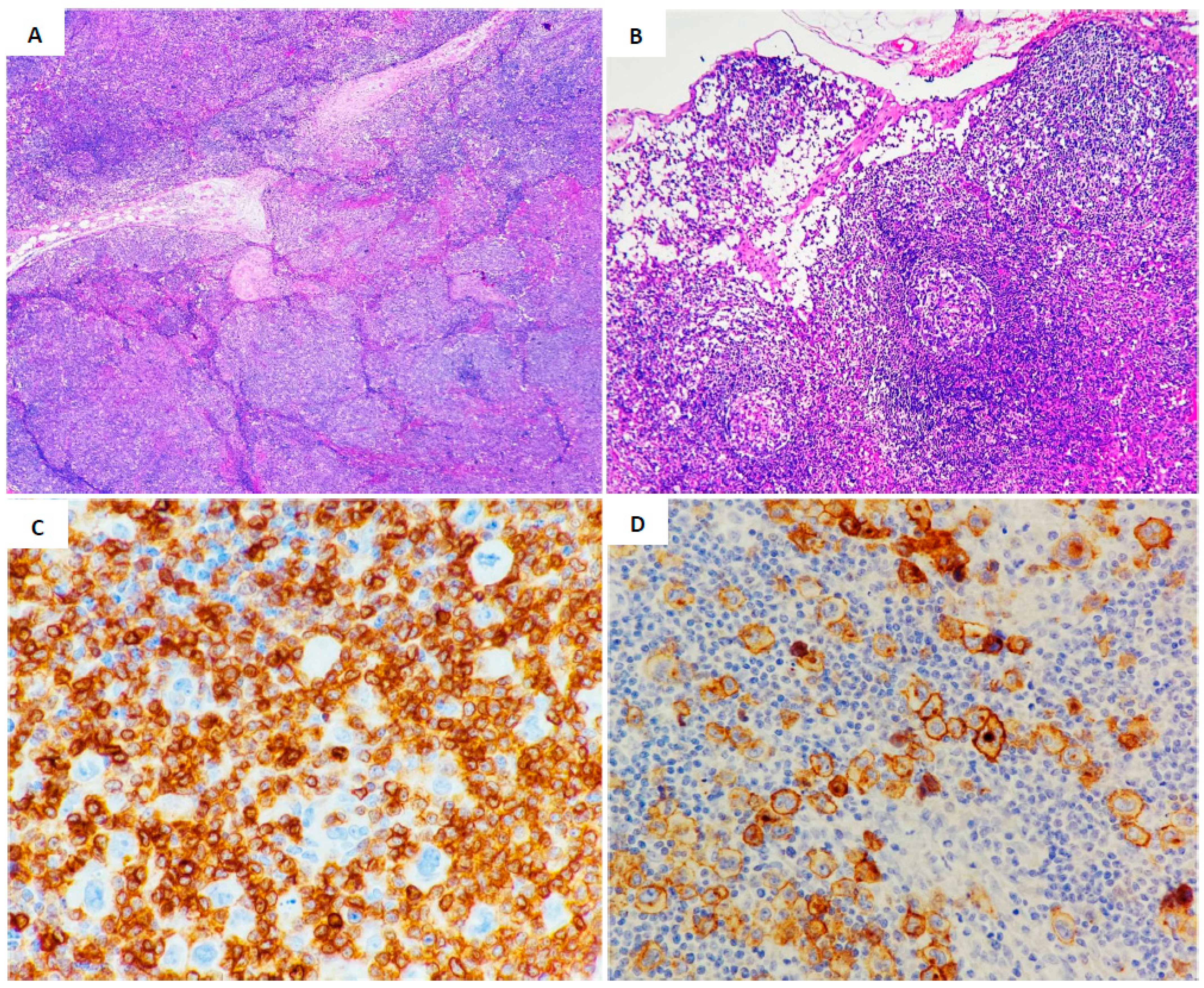 Lymphatics 02 00014 g002