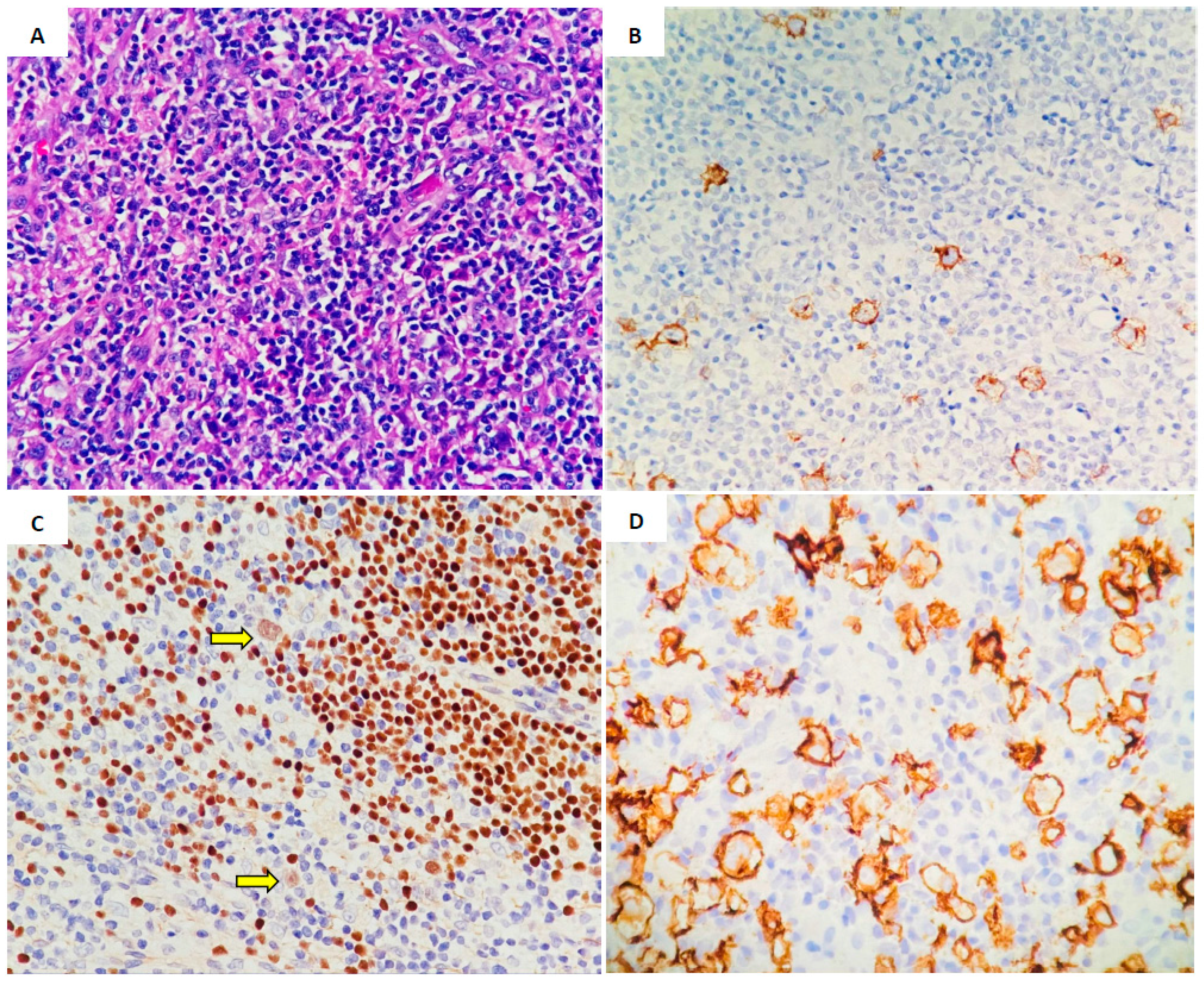 Lymphatics 02 00014 g003