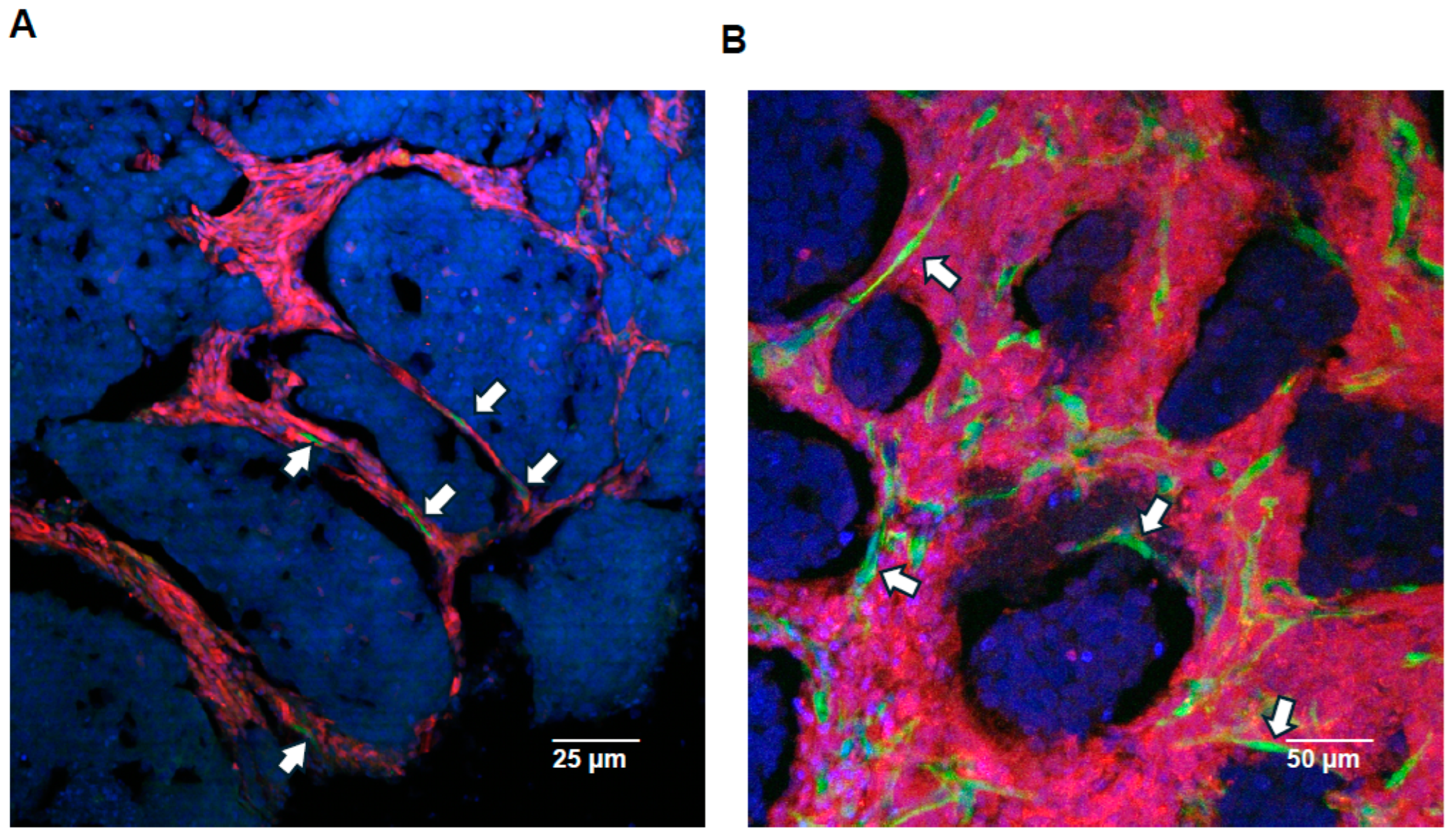 Lymphatics 02 00016 g006
