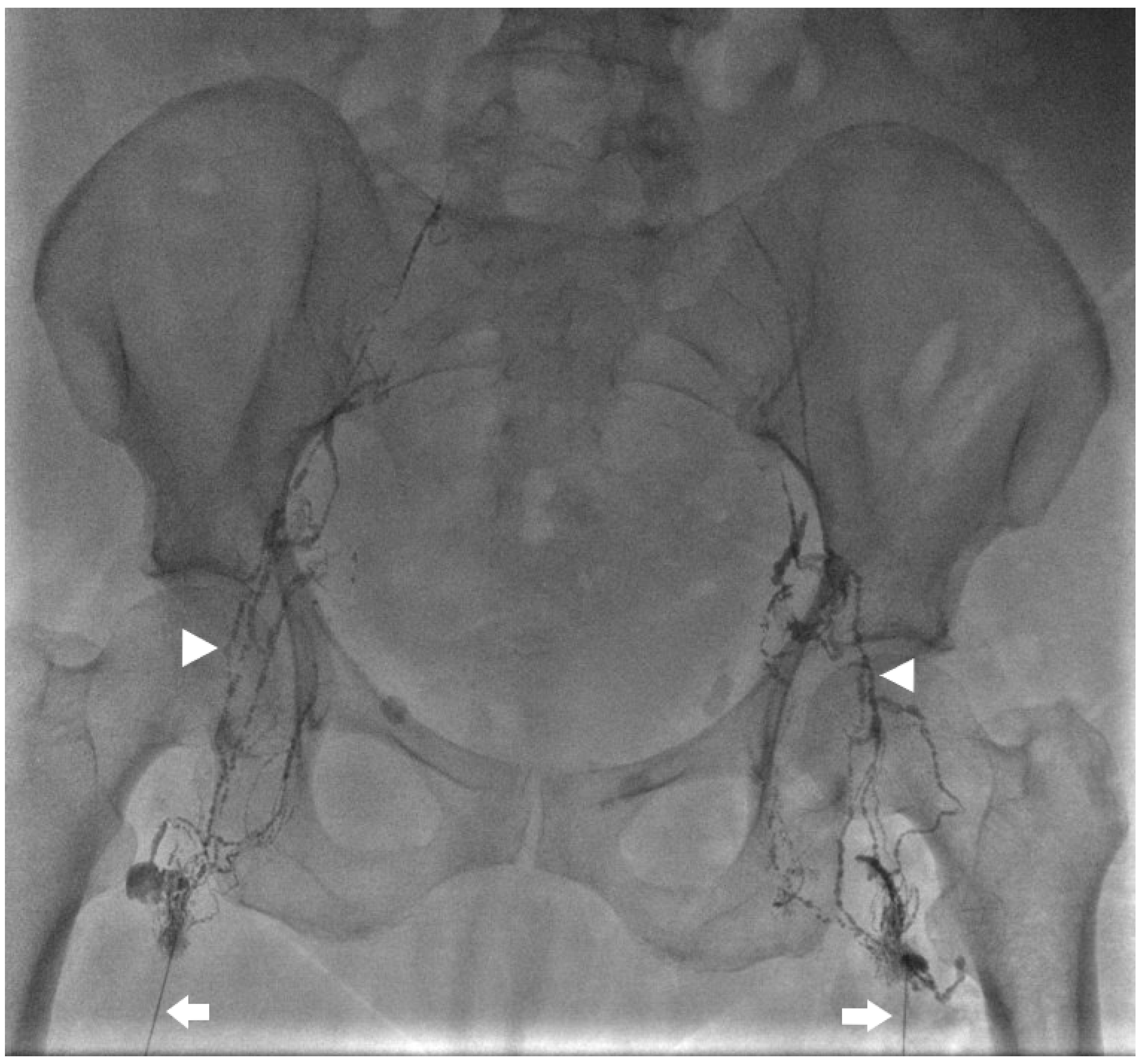 Lymphatics 02 00018 g003
