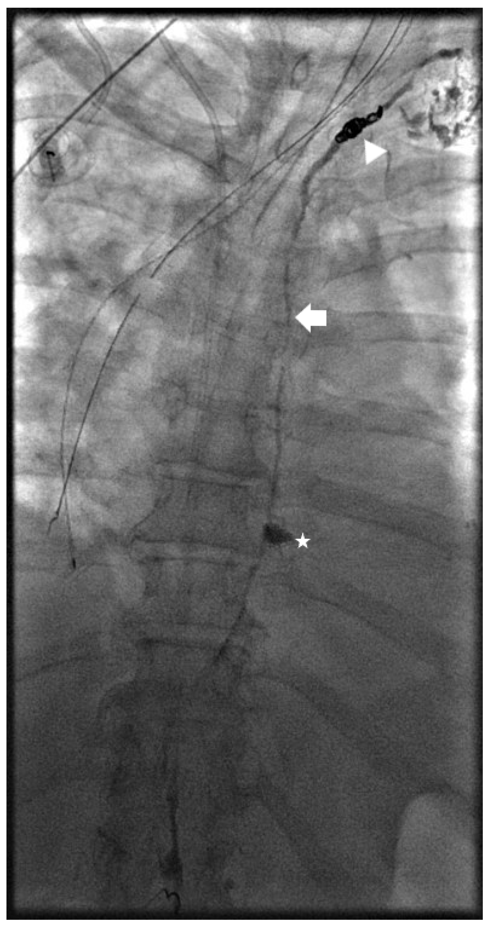 Lymphatics 02 00018 g004