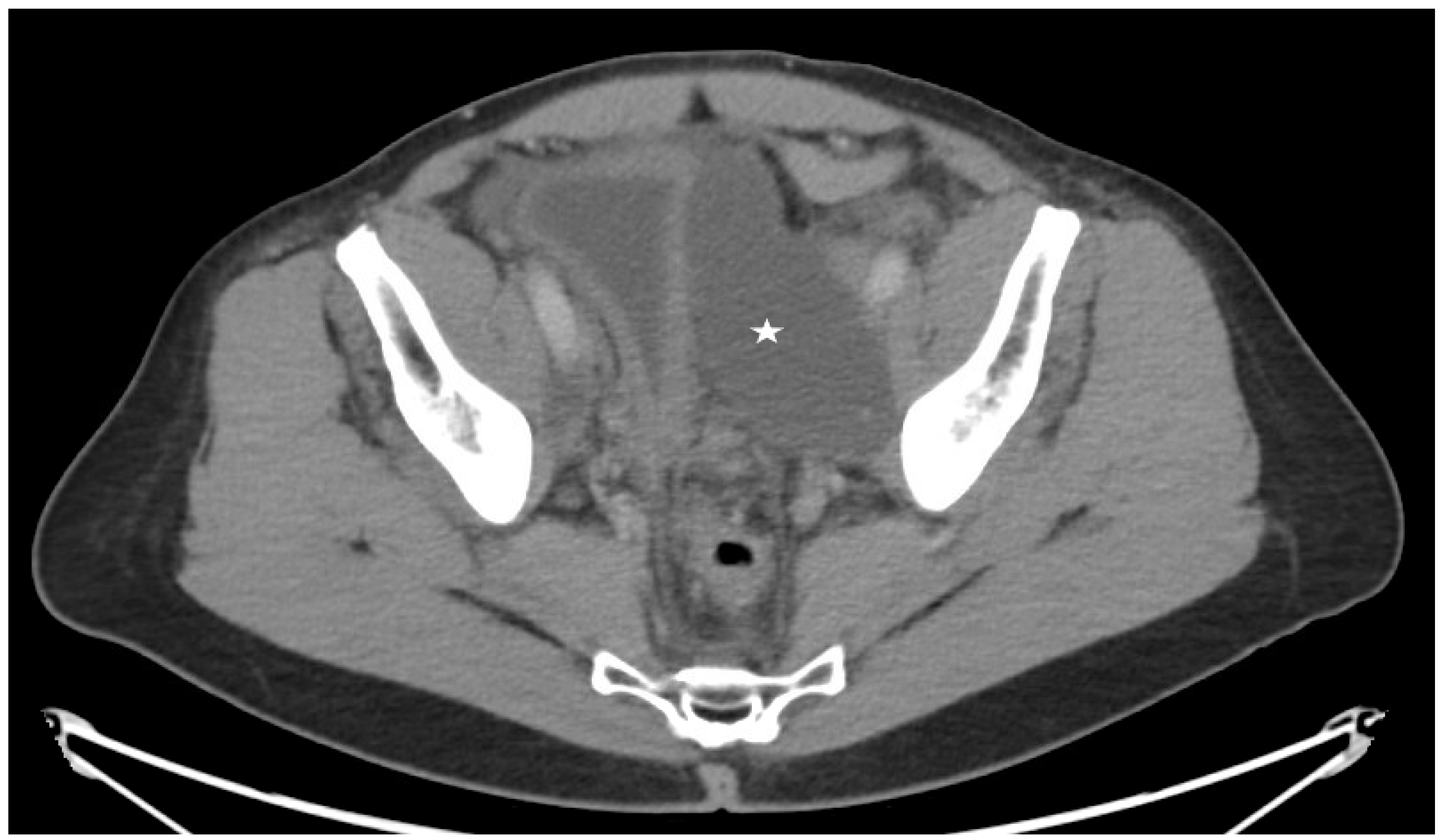 Lymphatics 02 00018 g005