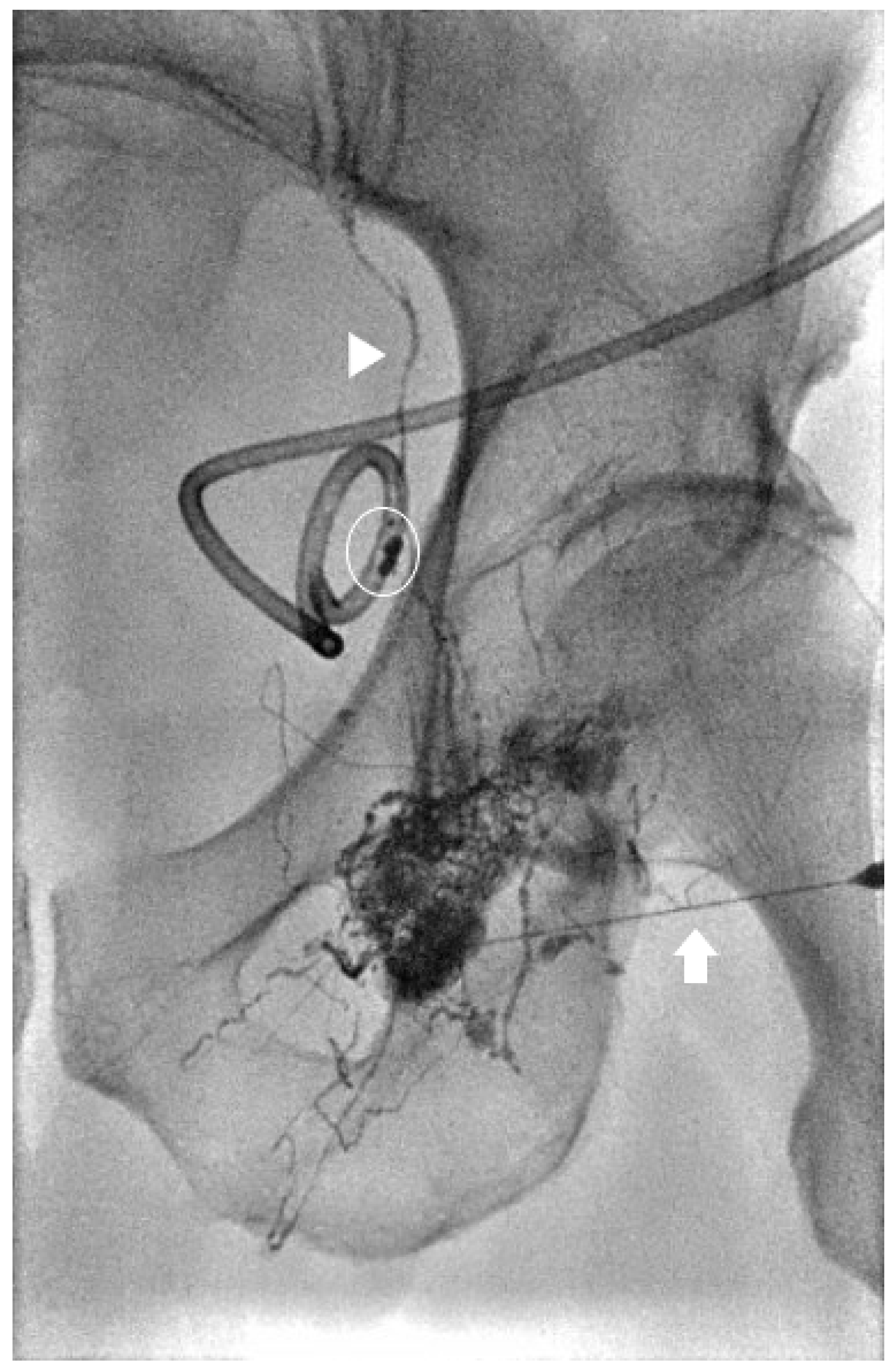 Lymphatics 02 00018 g006