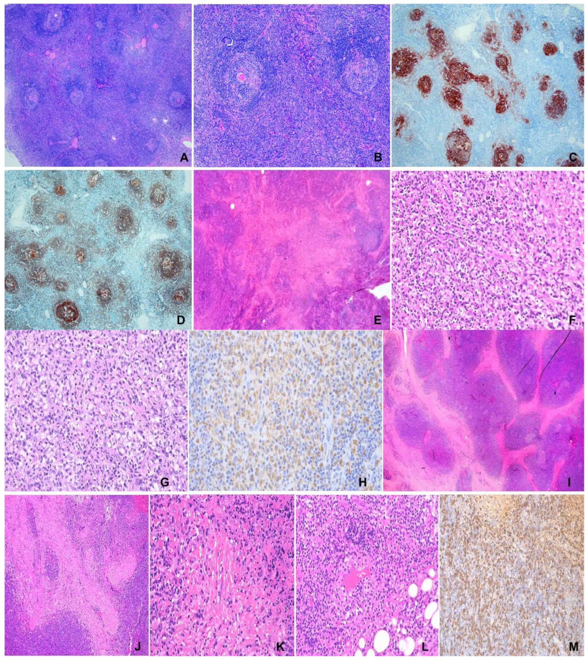 Lymphatics 03 00009 g001