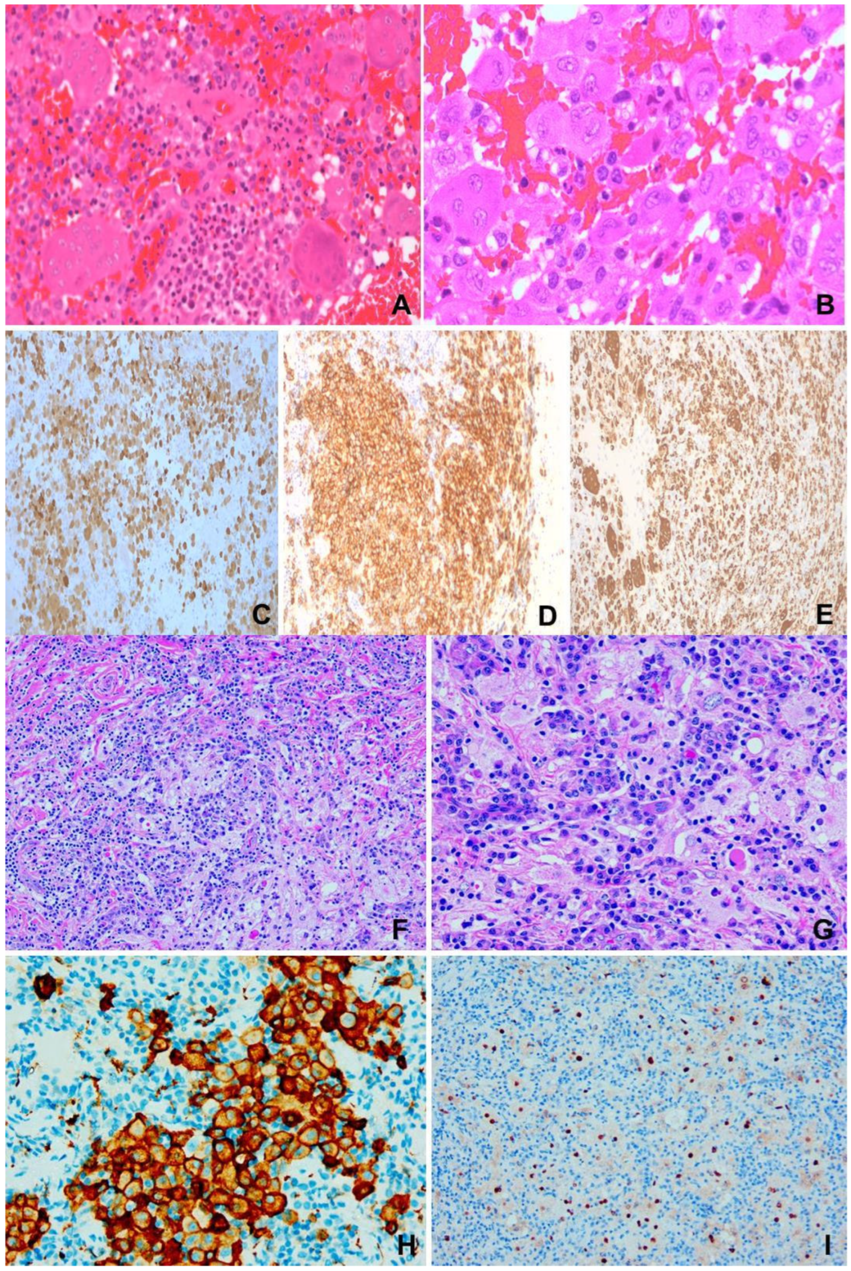 Lymphatics 03 00009 g002