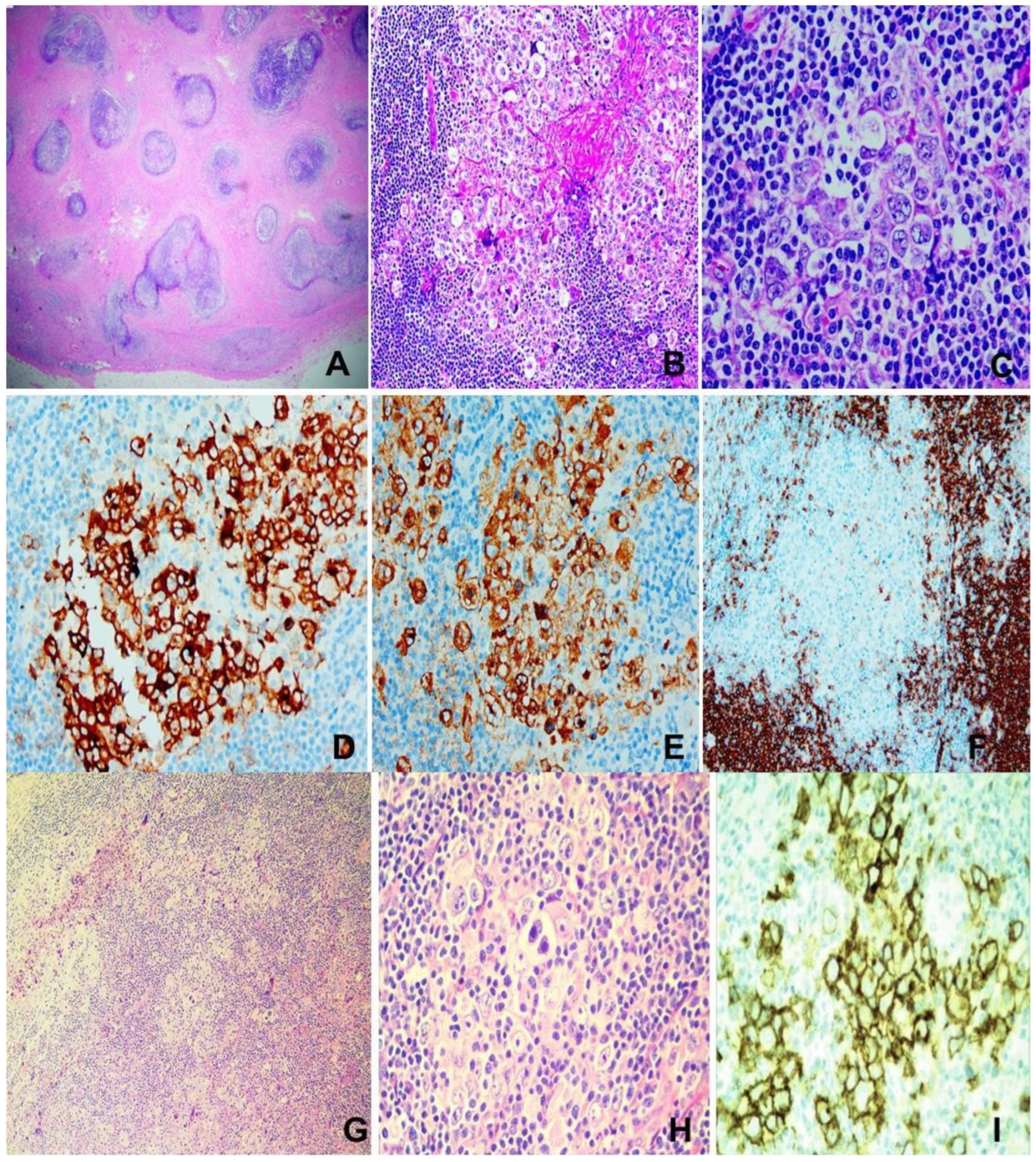 Lymphatics 03 00009 g003