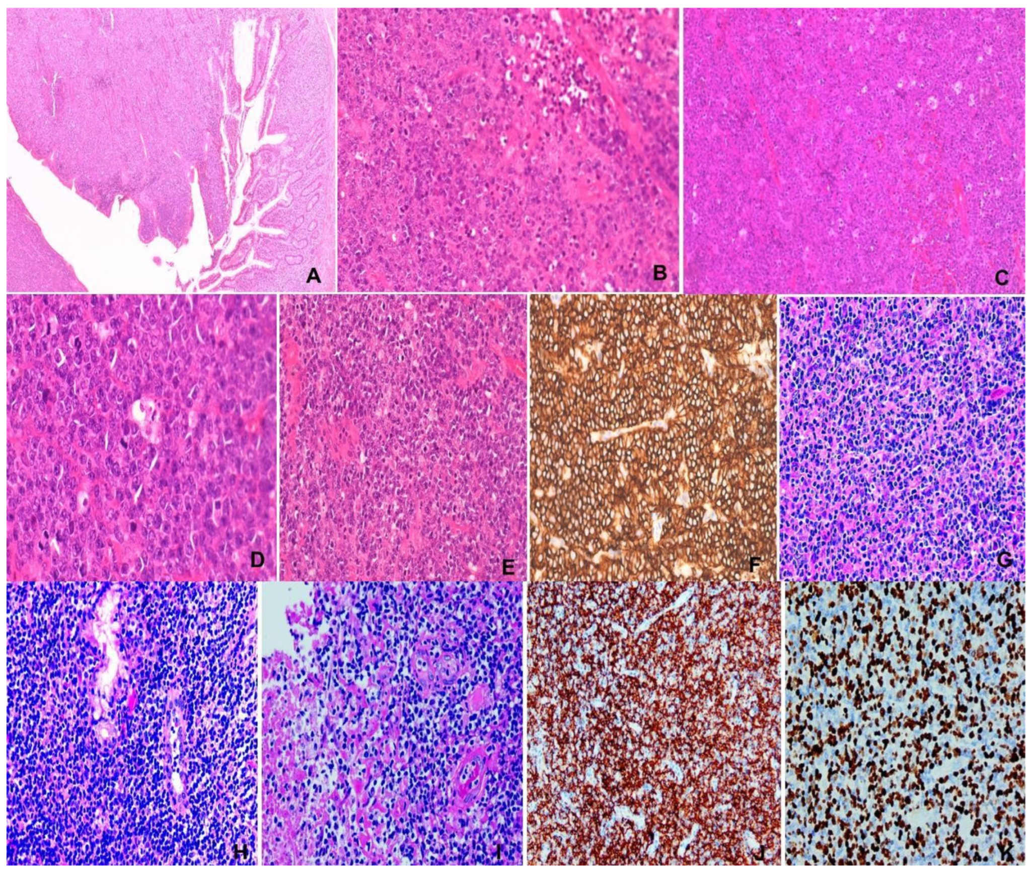 Lymphatics 03 00009 g004