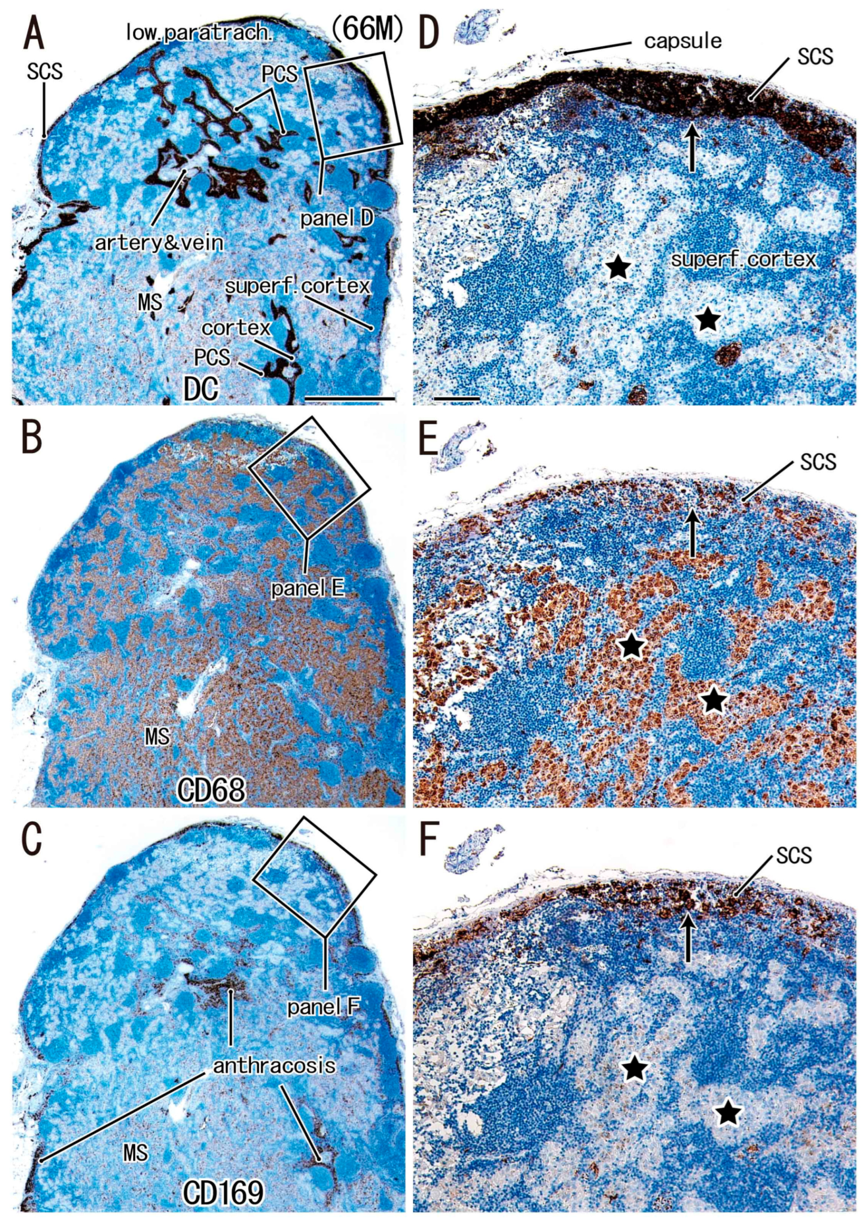 Lymphatics 03 00013 g002