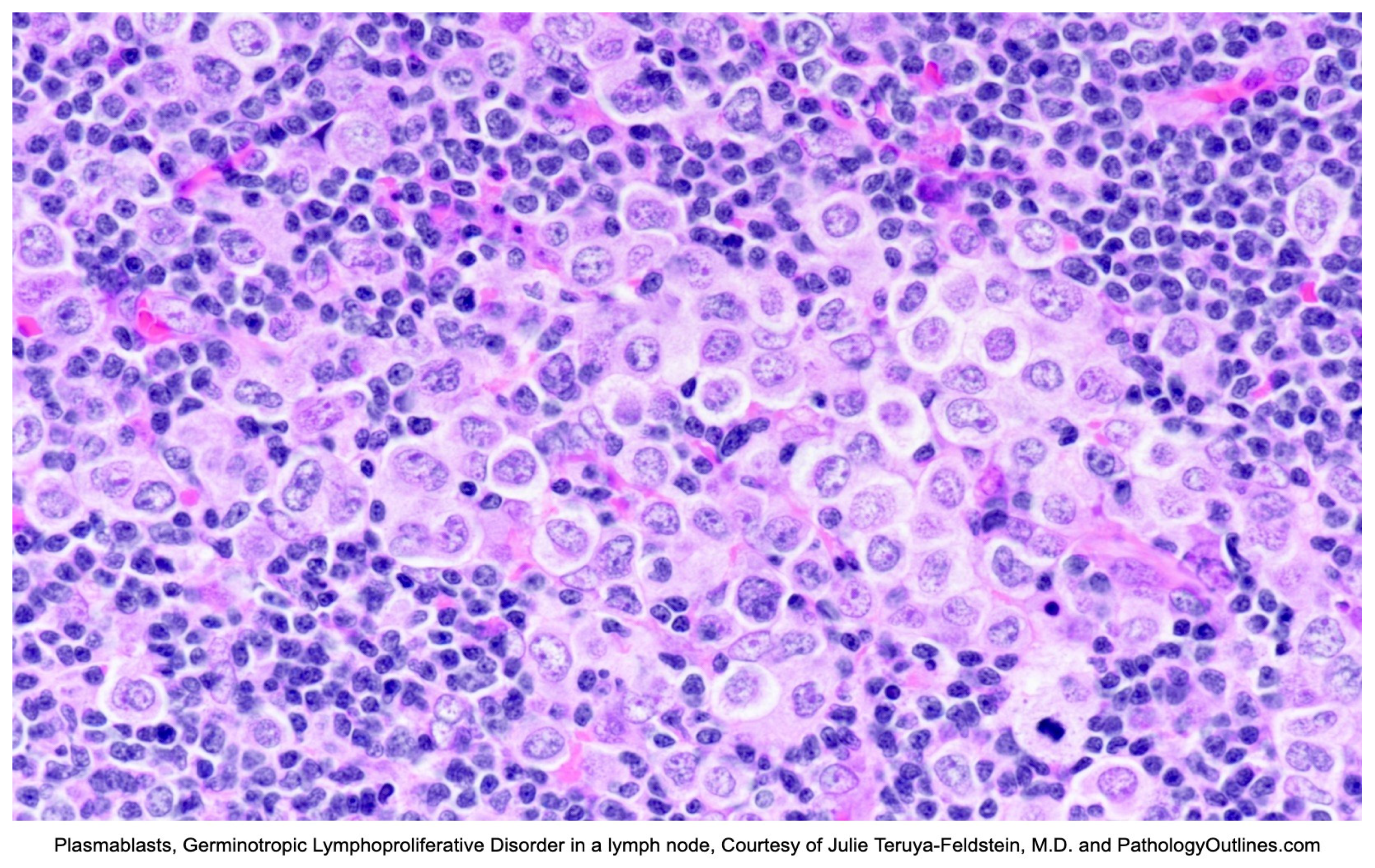 Lymphatics 03 00020 g005