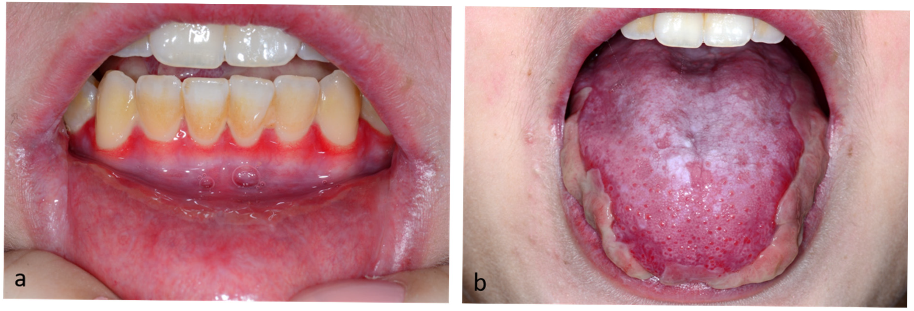 Lymphatics 03 00030 g001