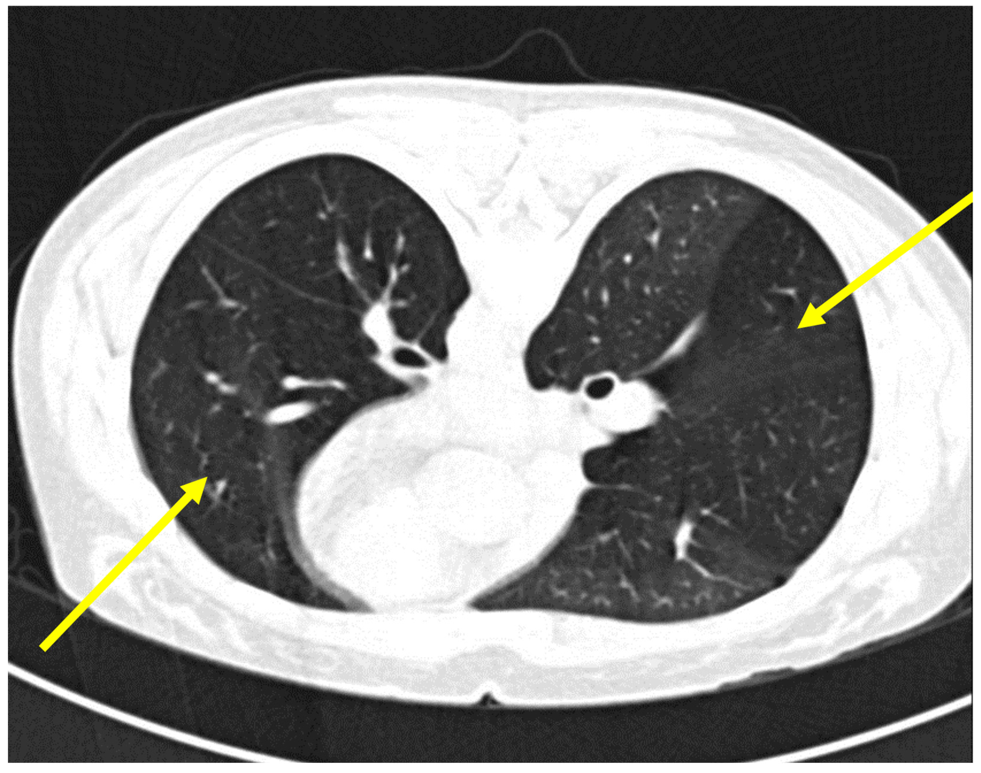 Lymphatics 03 00030 g002