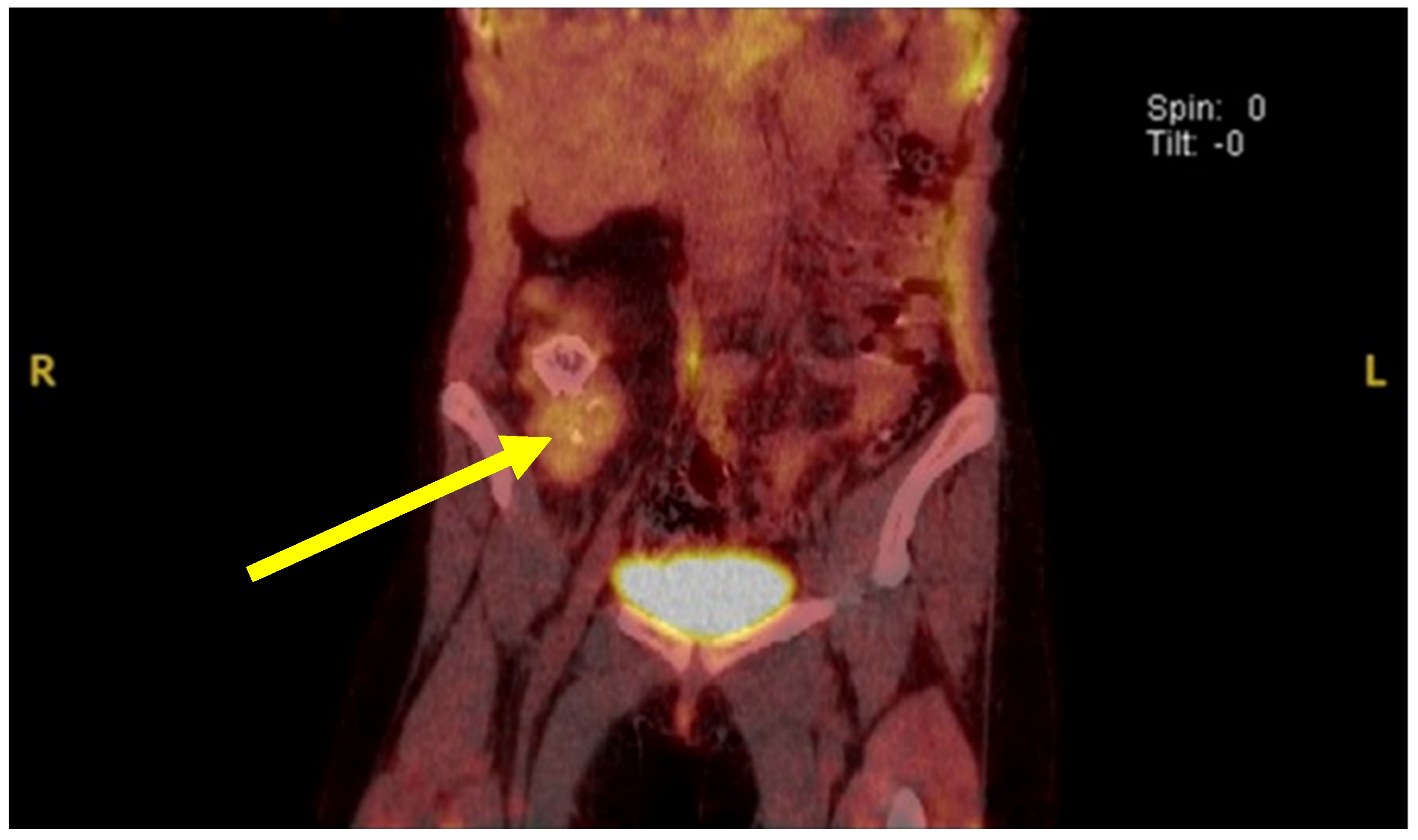 Lymphatics 03 00030 g003