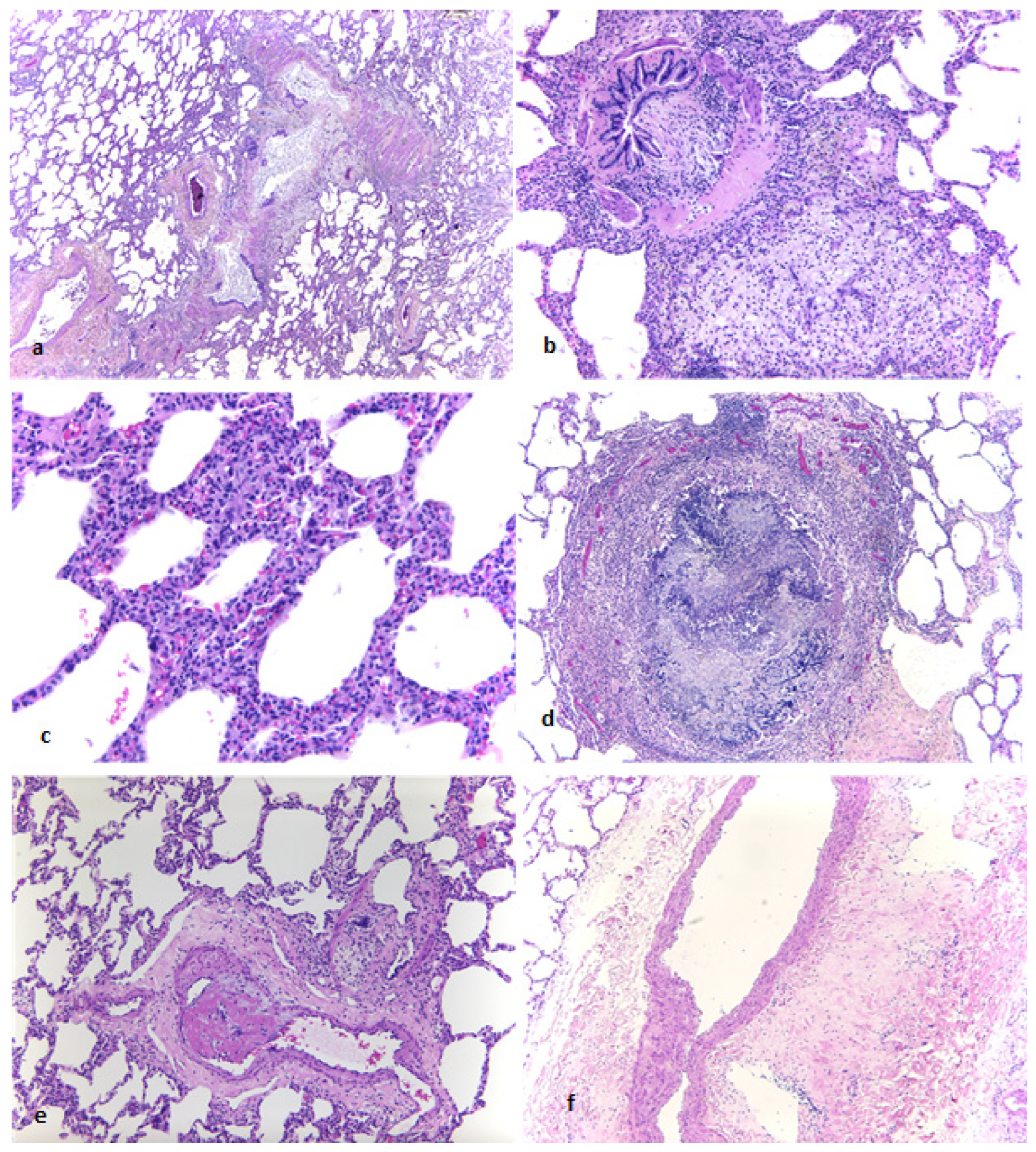 Lymphatics 03 00030 g005