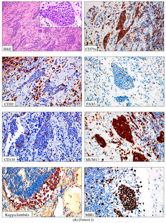 Lymphatics 03 00040 g001a Lymphatics 03 00040 g001a
