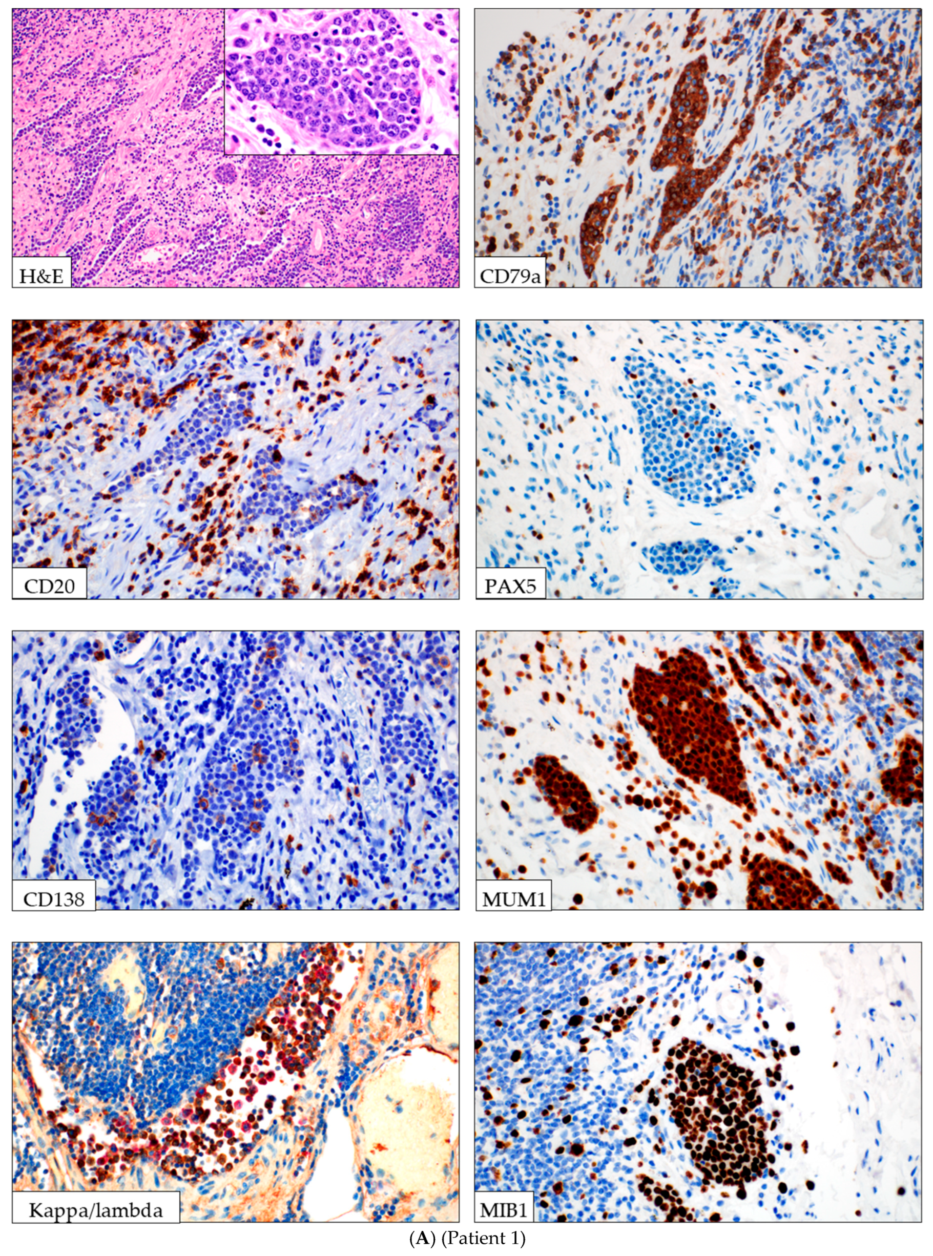 Lymphatics 03 00040 g001a Lymphatics 03 00040 g001a