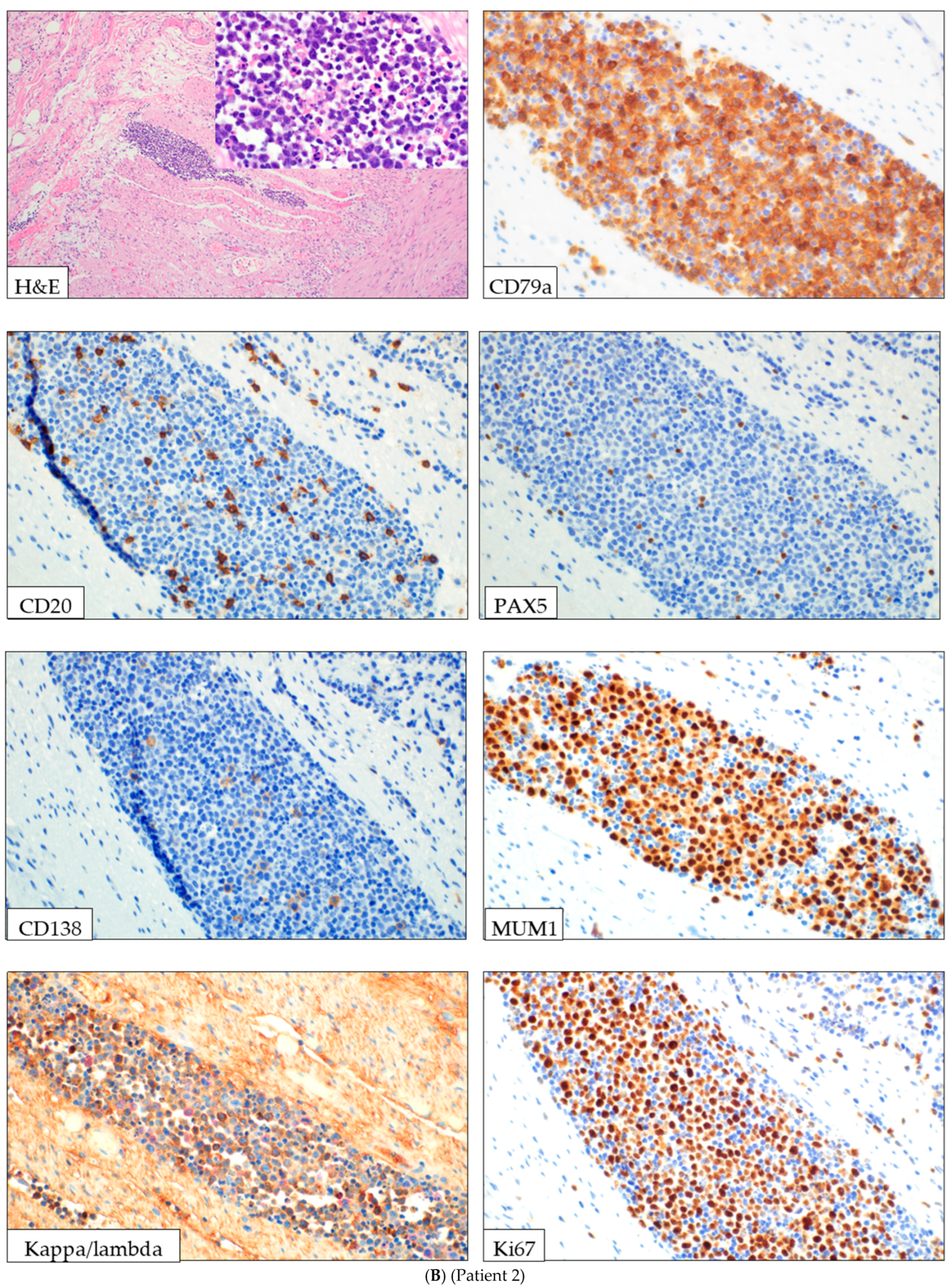 Lymphatics 03 00040 g001b Lymphatics 03 00040 g001b
