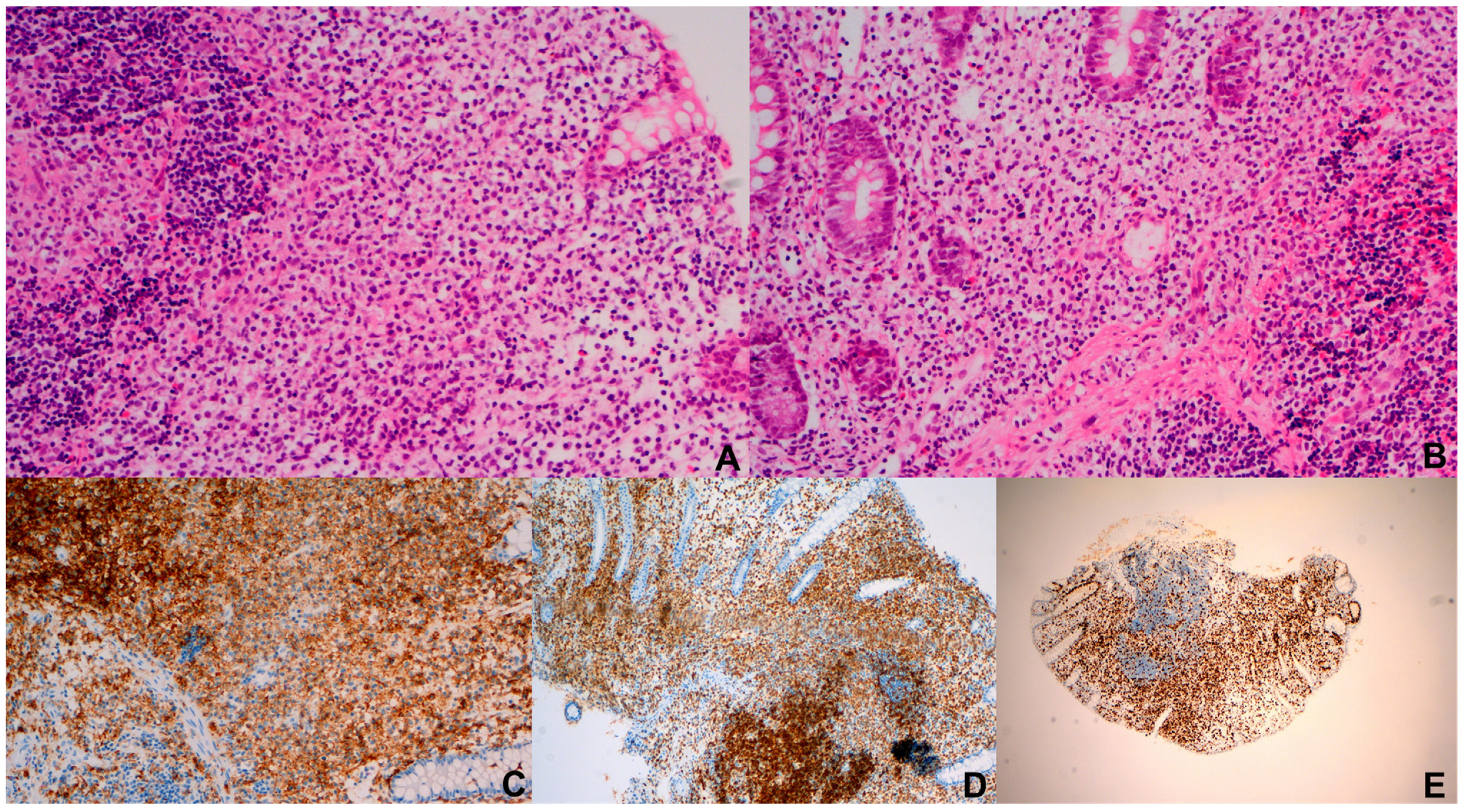 Lymphatics 03 00041 g002 Lymphatics 03 00041 g002