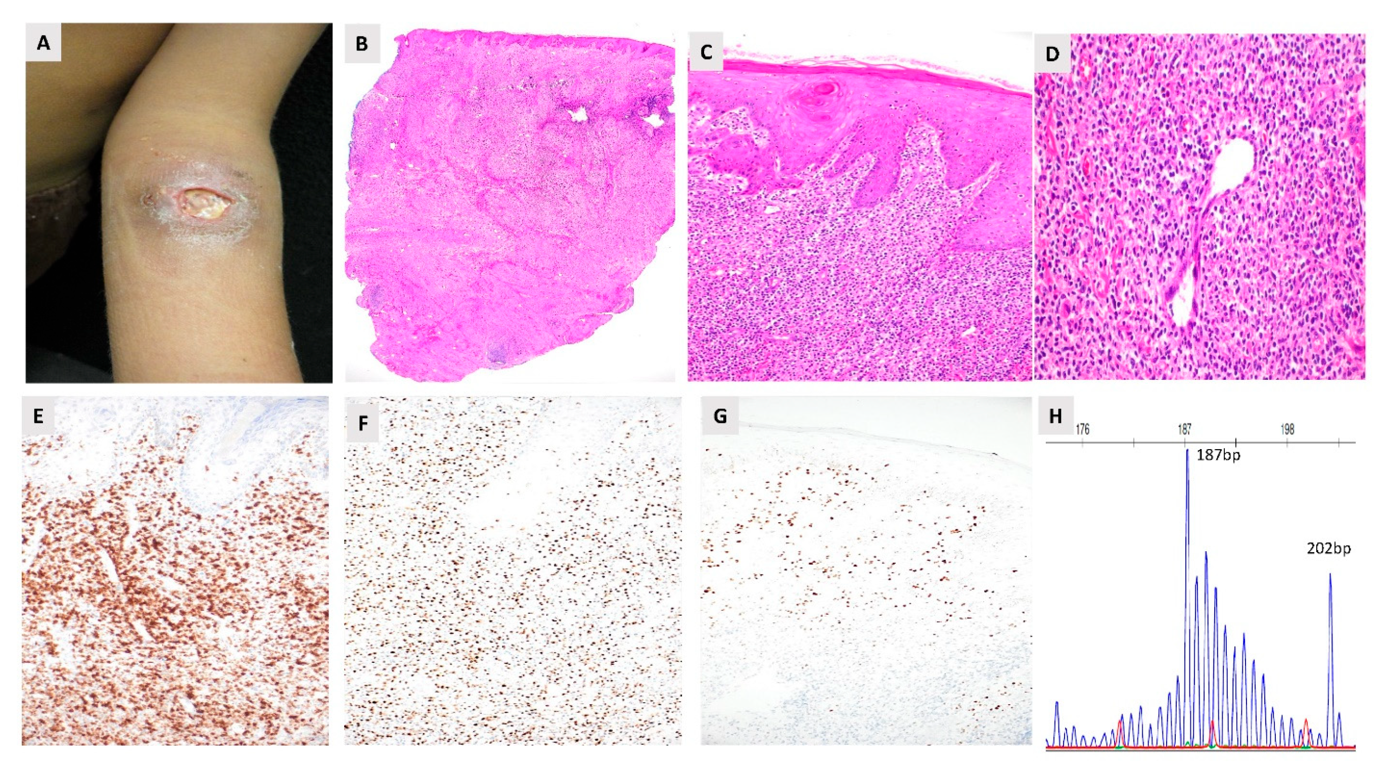 Lymphatics 04 00007 g002 Lymphatics 04 00007 g002