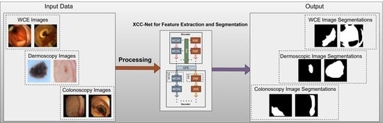 An overview of the proposed XCC-Net architecture illustrating its symmetric X-shaped design. The network includes two parallel encoding subnetworks, XSE and MCSE, connected through the PFE module. The outputs of these encoders are passed to the GFE bottleneck. The decoding stage consists of two corresponding subnetworks, XSD and MCSD, which produce the final segmentation output.