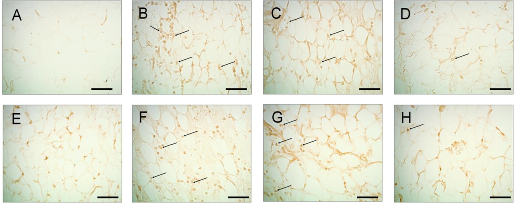 Marinedrugs 11 00099 g004 1024