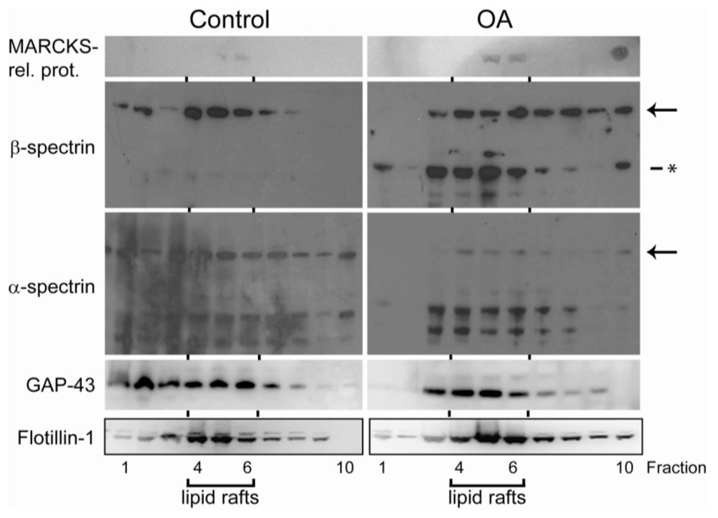 Marinedrugs 11 01763 g004 1024