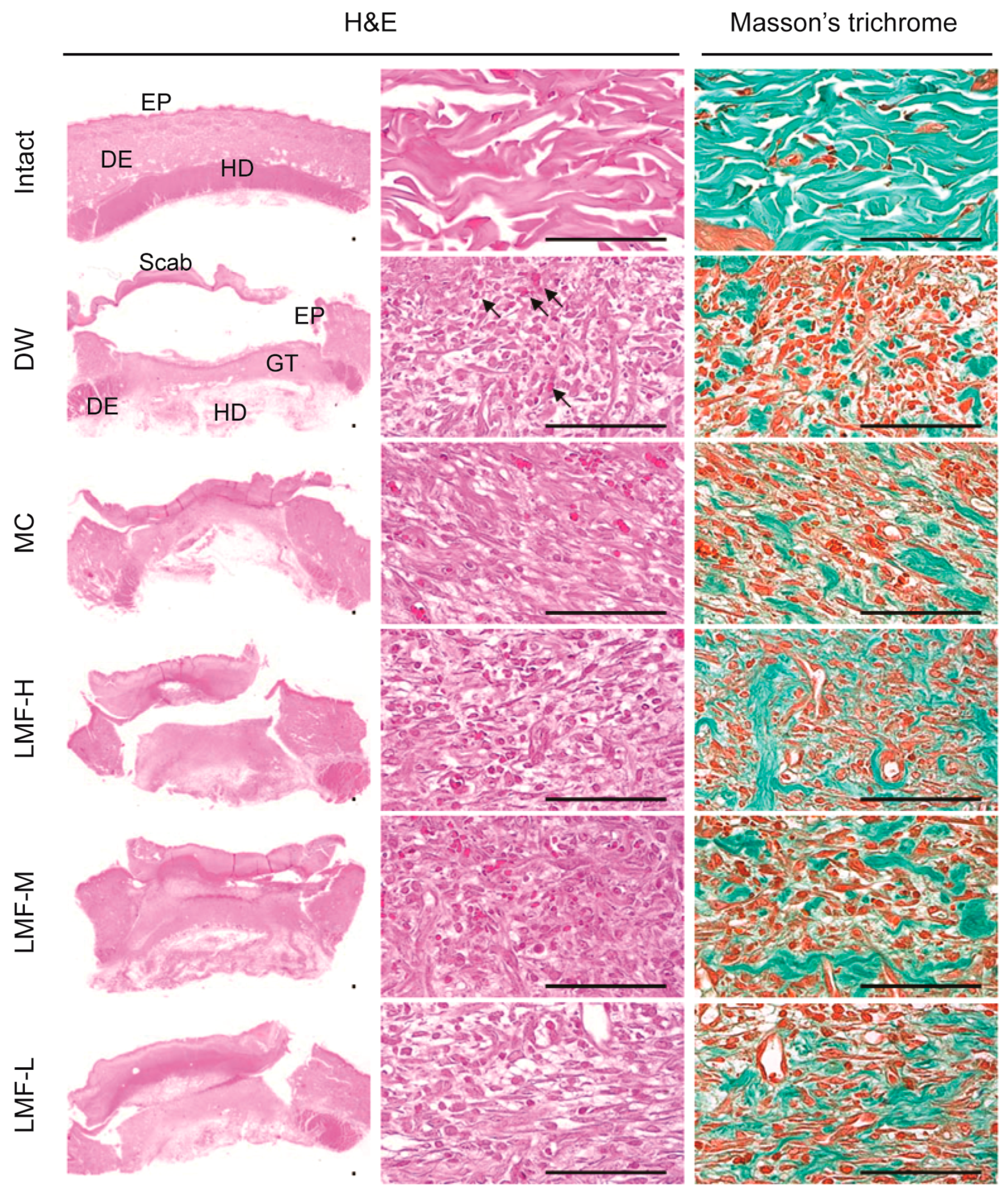 Marinedrugs 15 00112 g003