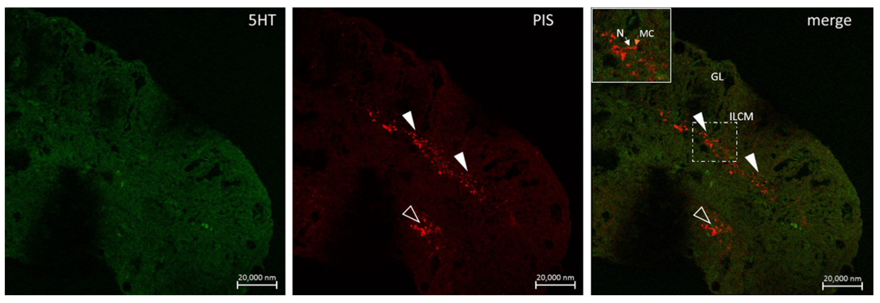 Marinedrugs 20 00145 g011