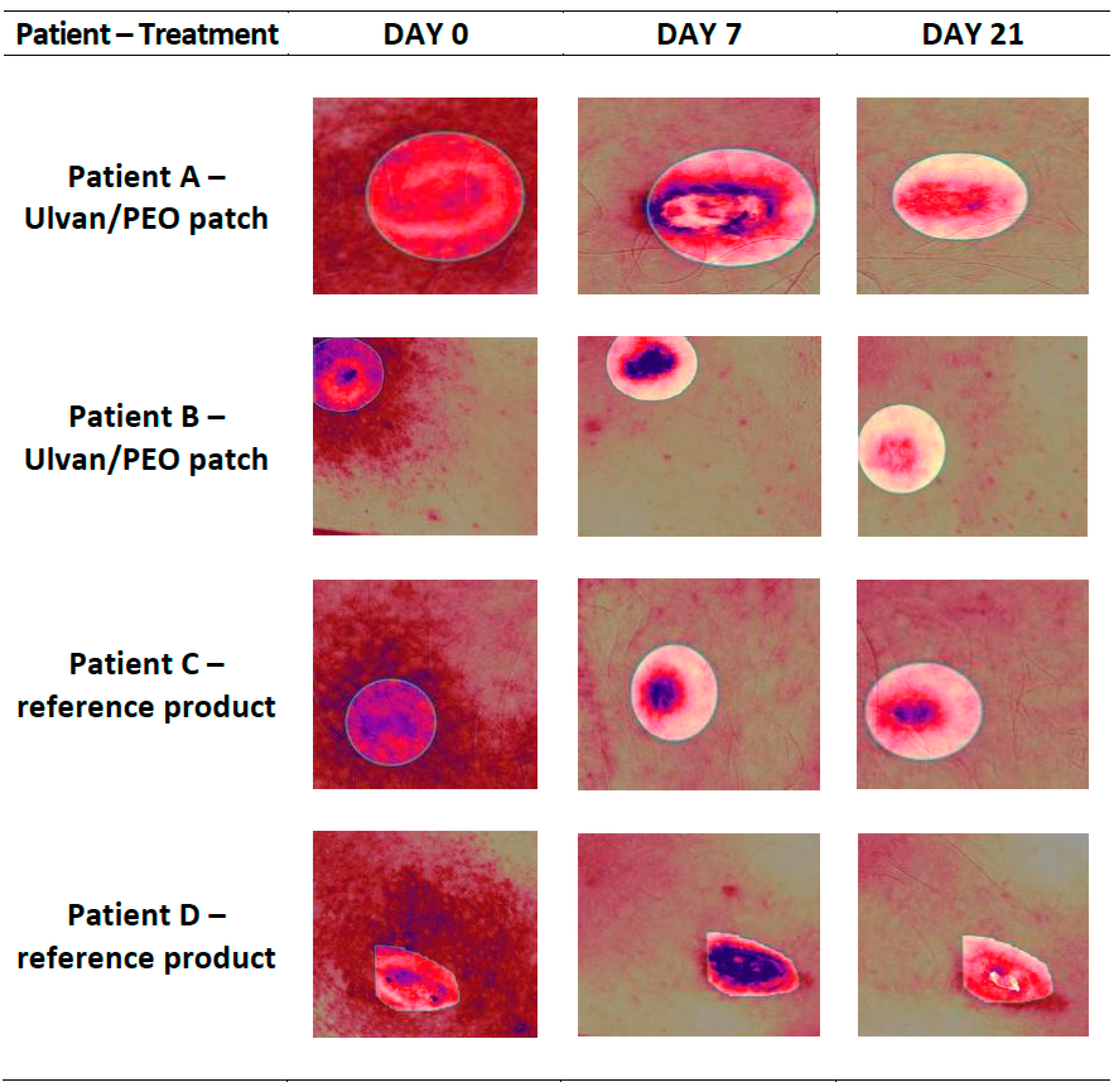 Marinedrugs 20 00551 g005