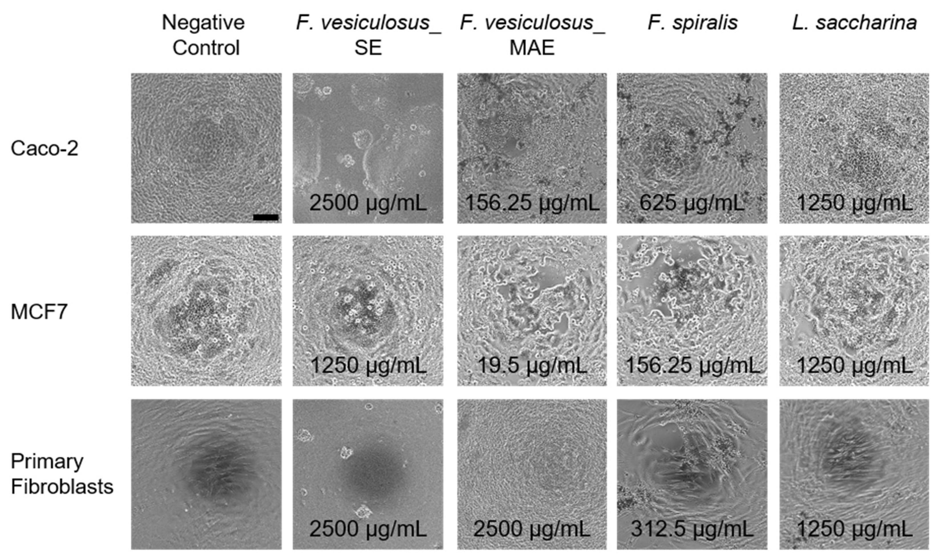 Marinedrugs 21 00048 g003 Marinedrugs 21 00048 g003