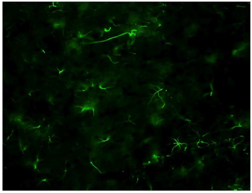 Materials 02 01762 g005 1024