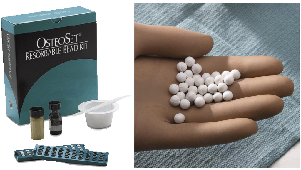 Materials 03 01138 g004 1024