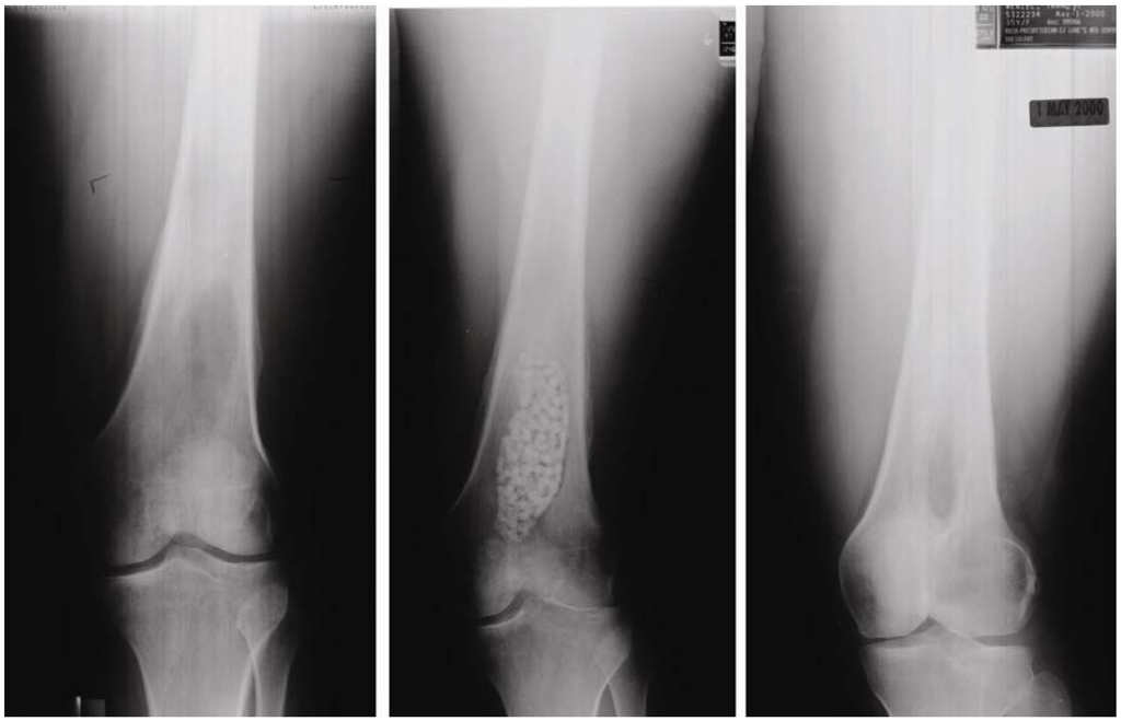 Materials 03 01138 g005 1024