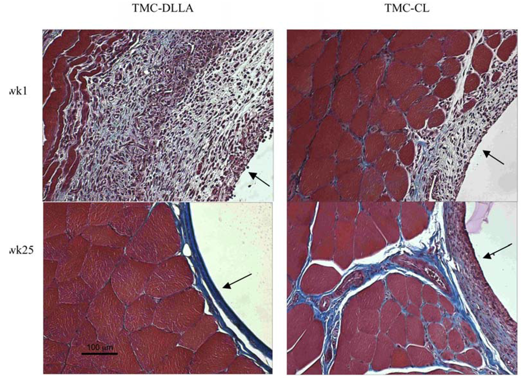 Materials 03 01156 g006 1024