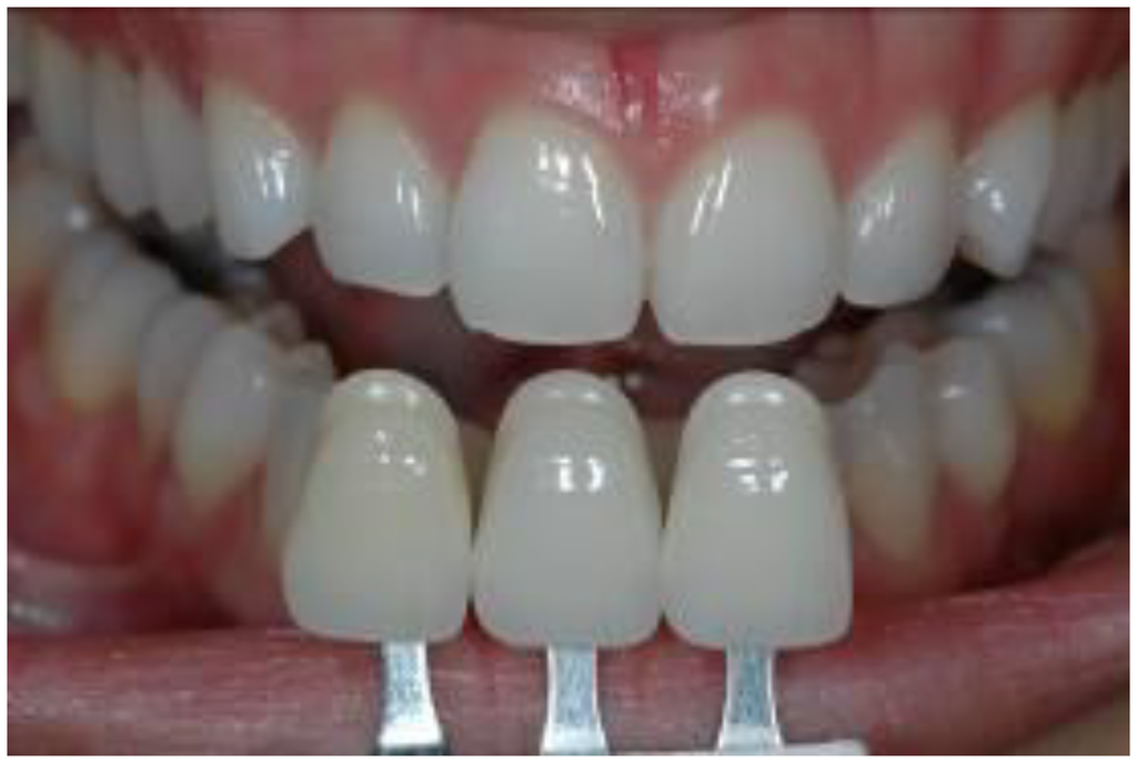 Materials 03 03694 g002 1024