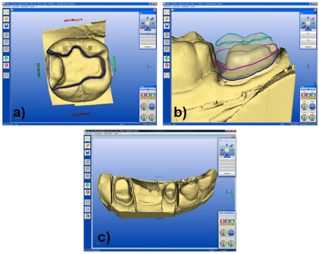 Materials 03 03700 g006 1024