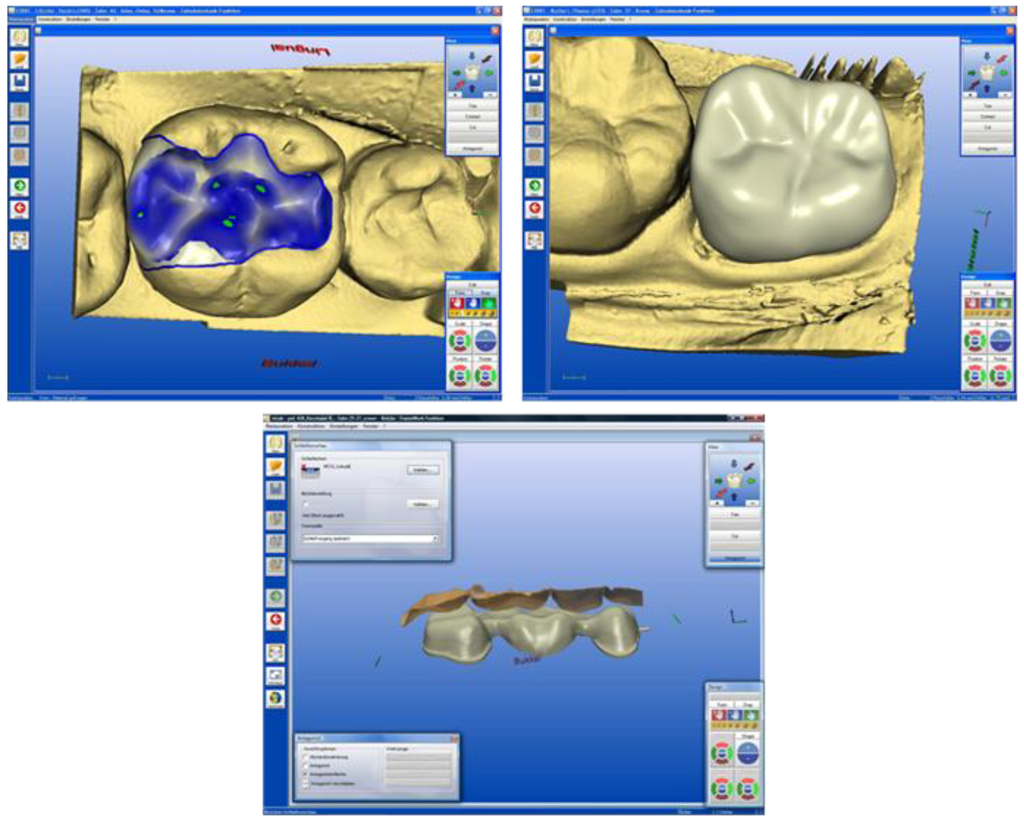 Materials 03 03700 g007 1024