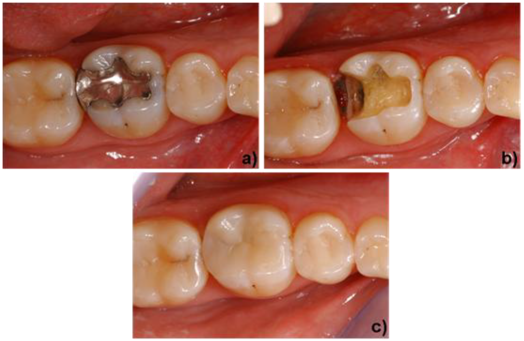 Materials 03 03700 g008 1024