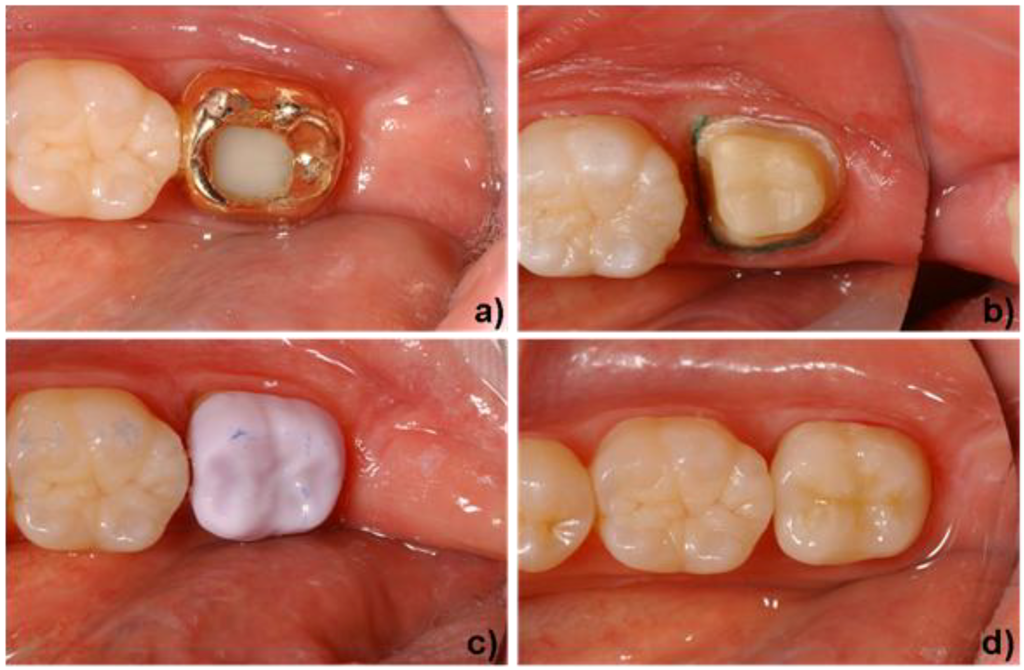 Materials 03 03700 g009 1024