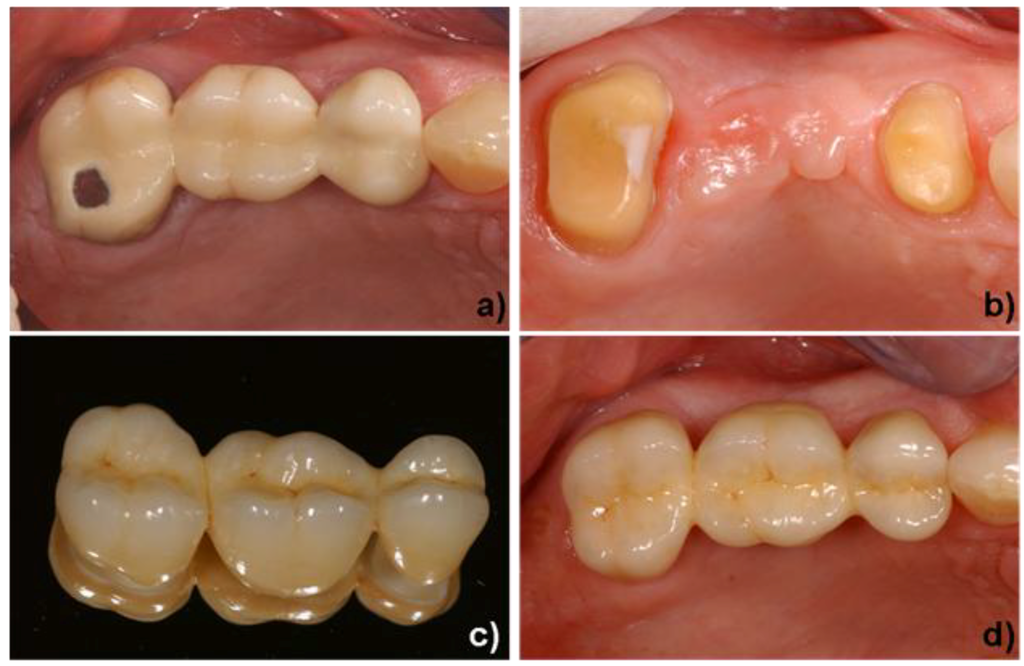 Materials 03 03700 g010 1024