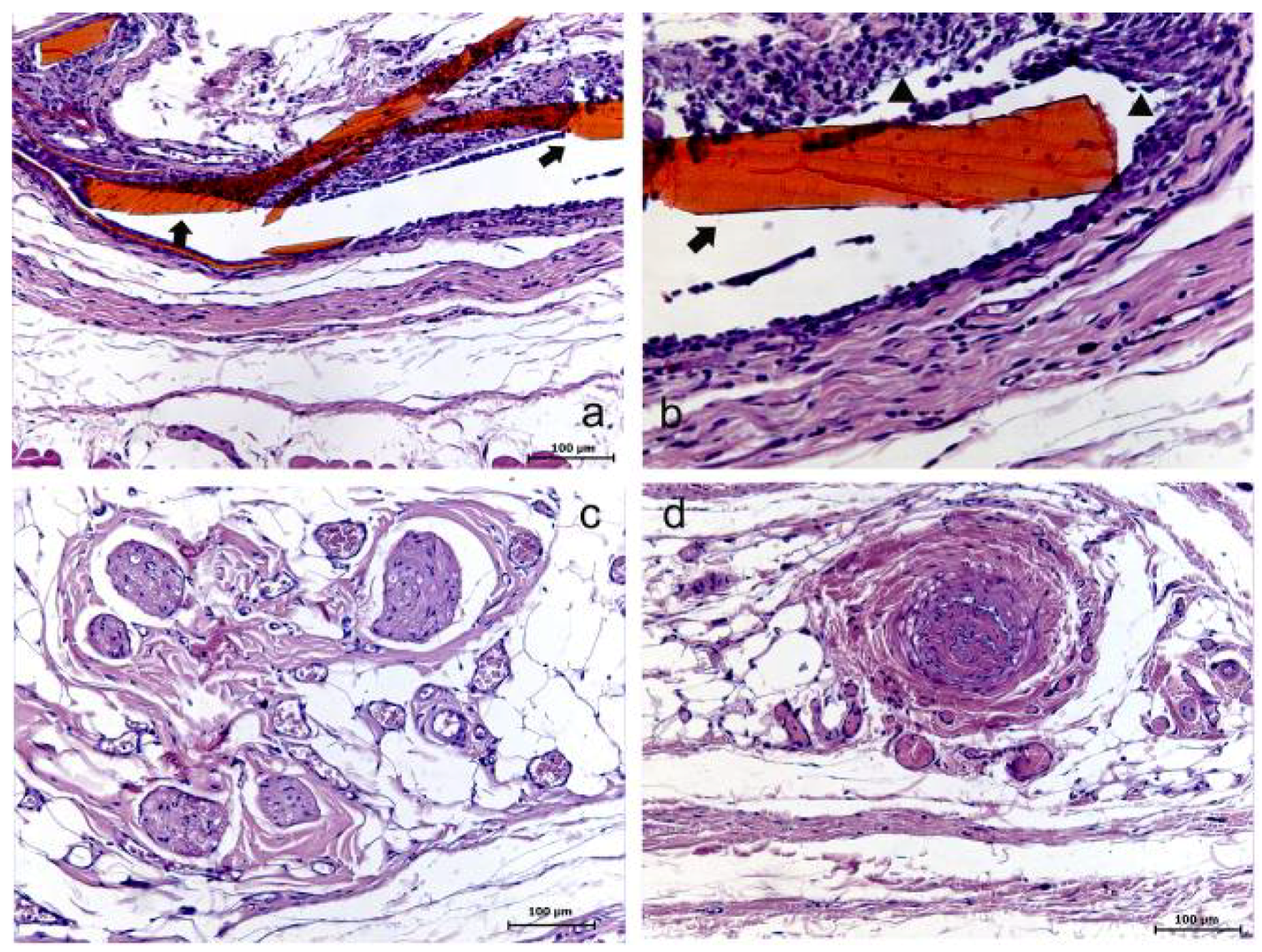 Materials 04 00380 g004