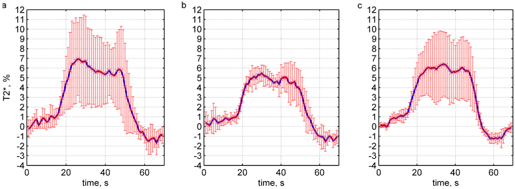 Materials 04 01548 g004 1024
