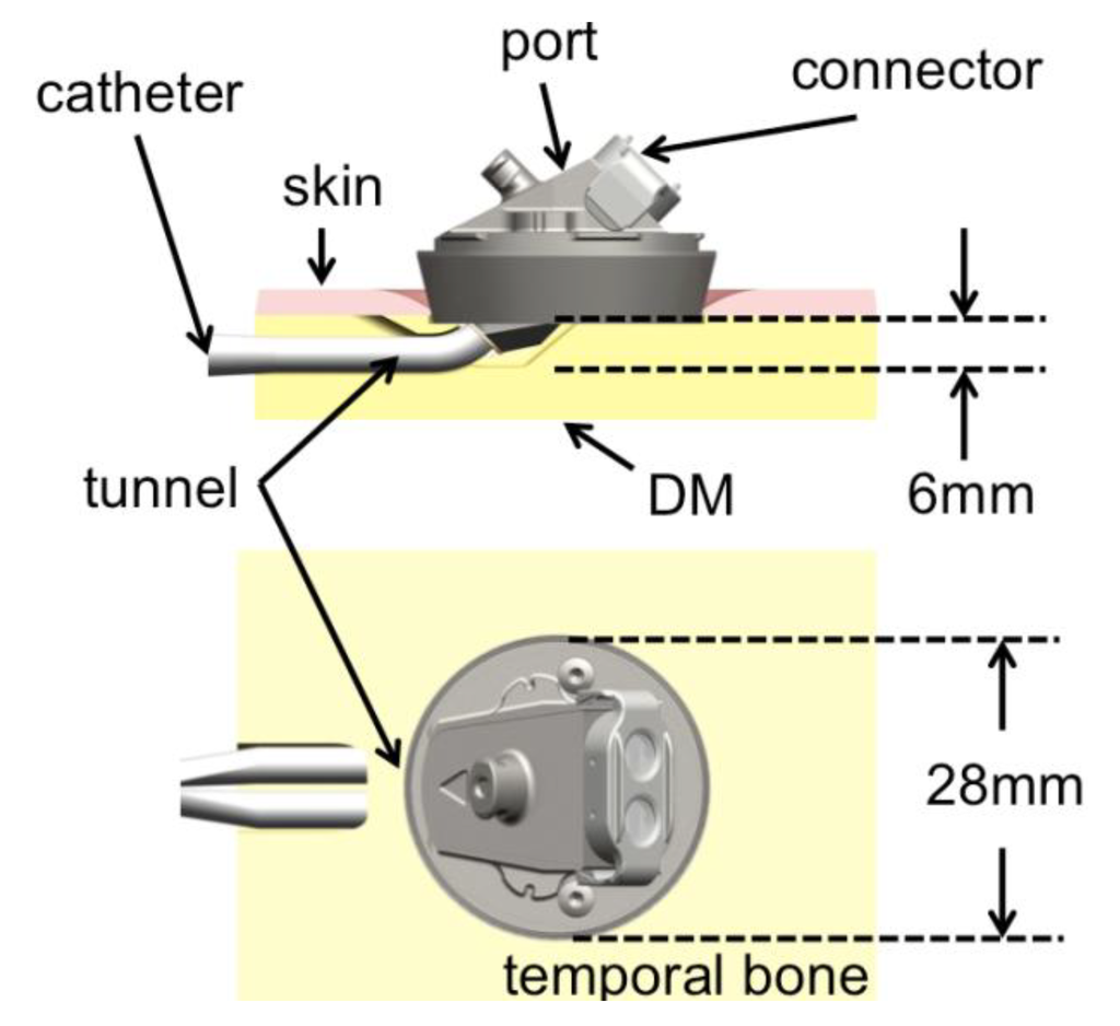 Materials 06 05291 g001 1024