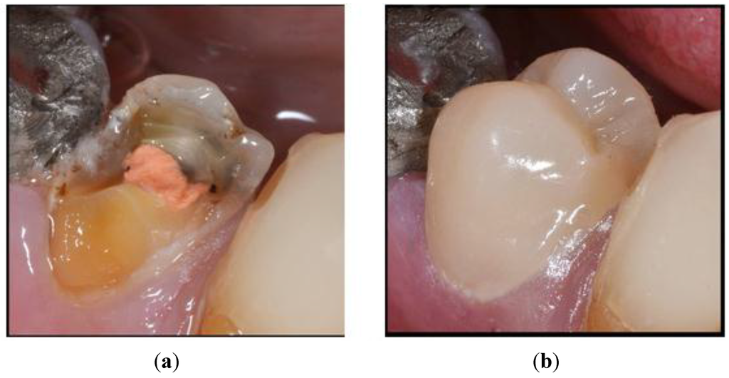 Materials 08 00717 g002 1024